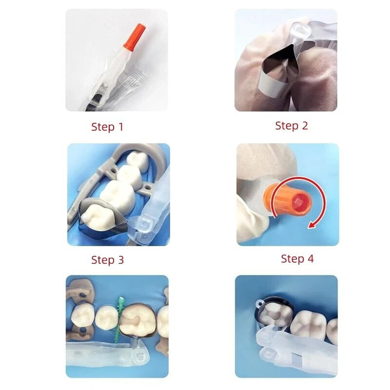 24Pcs/Box Dental Pro Matrix Bands Adjustable Pre Formed Retainer Matrix 4 Sizes