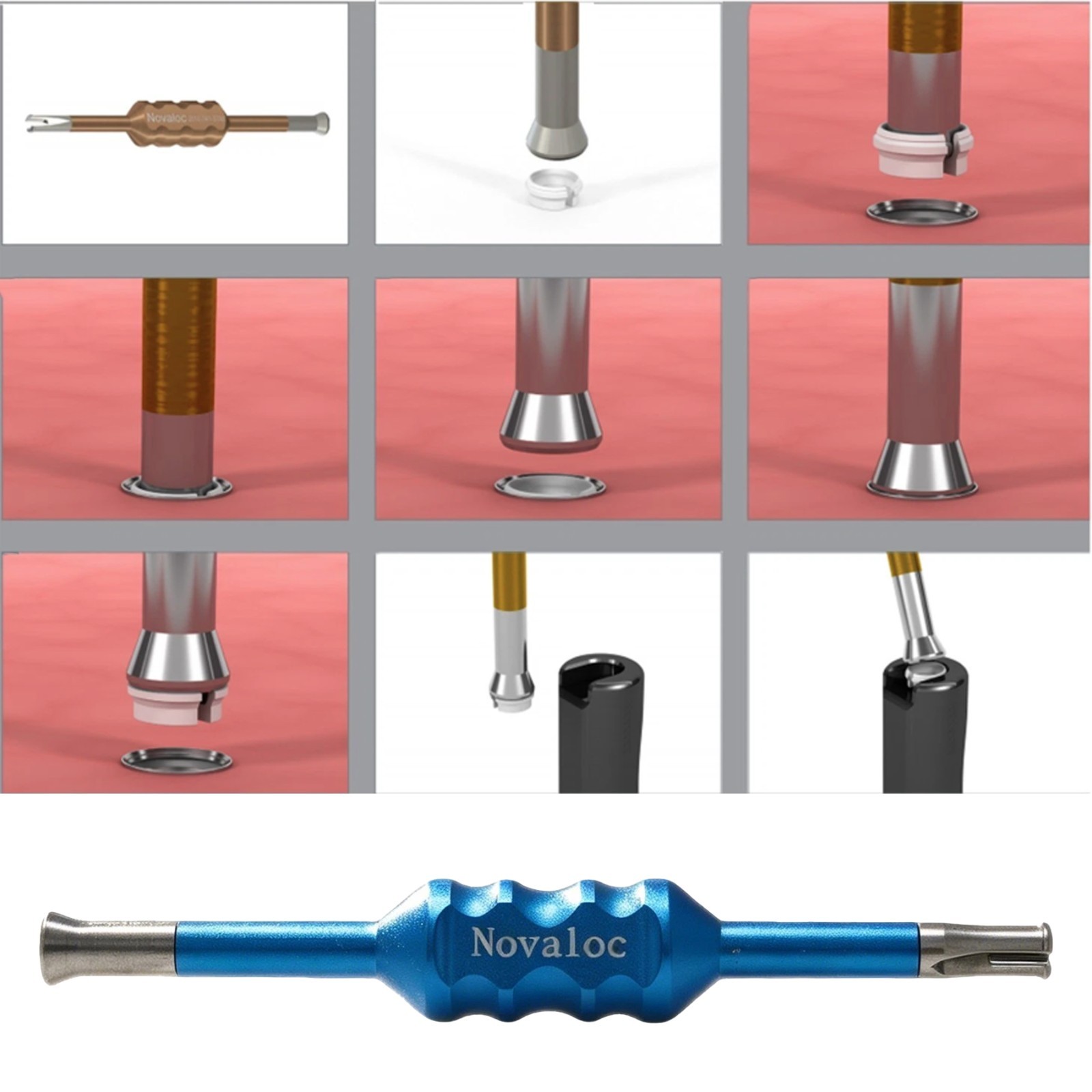 US Dental Novaloc Retention Inserts Caps Peek and Mounting&Demounting Core Tool