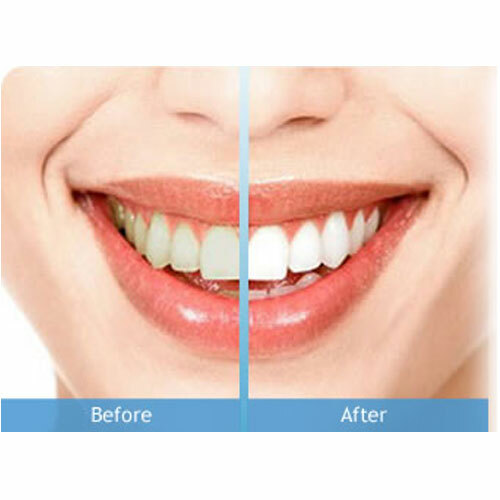 Dental DSI Prophy Air Prophylaxis Powder Teeth Polish Stain Remove Cherry 300g