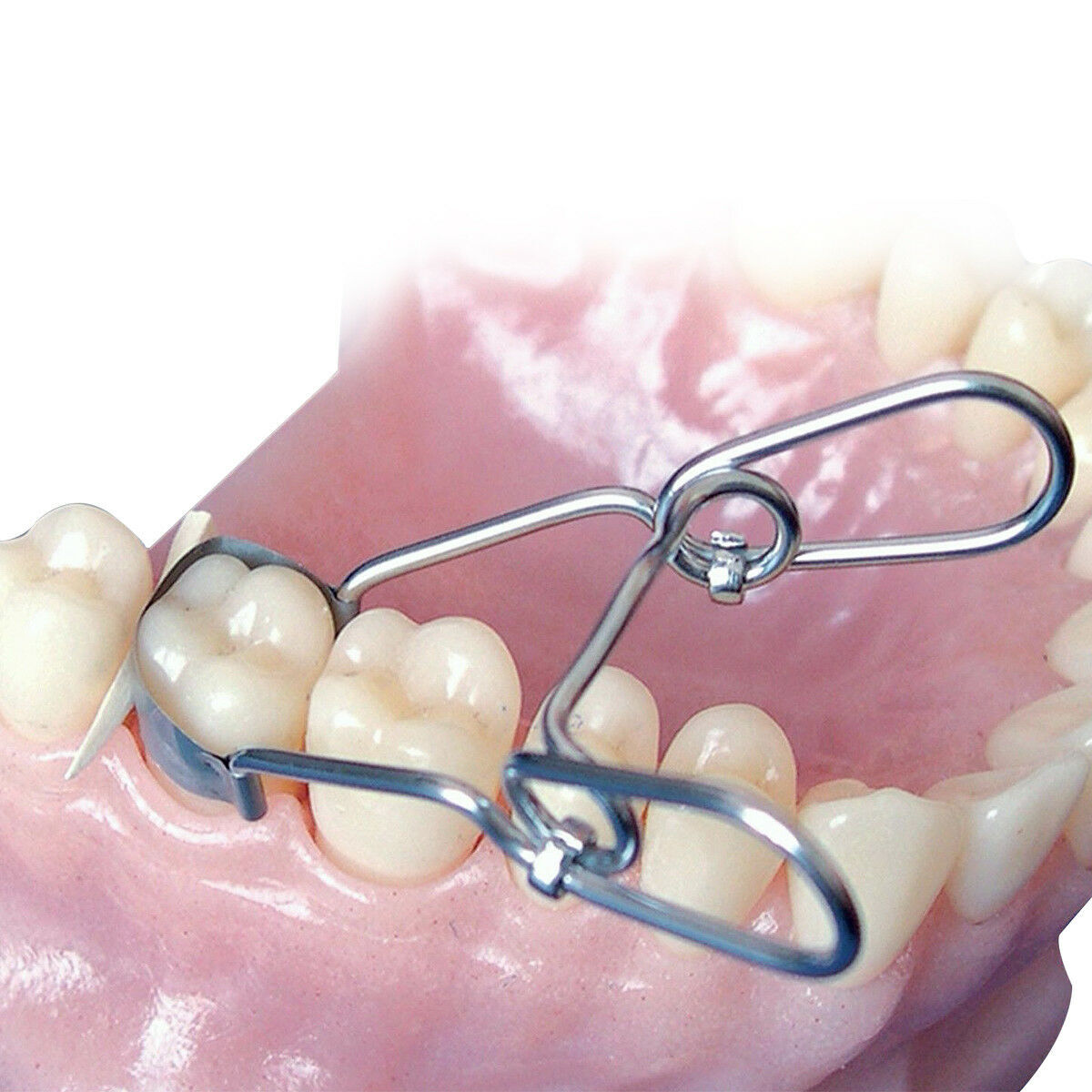 Dental Metal Matrix Band Saddle Sectional Contoured Matrices Springclip 35/50 μm