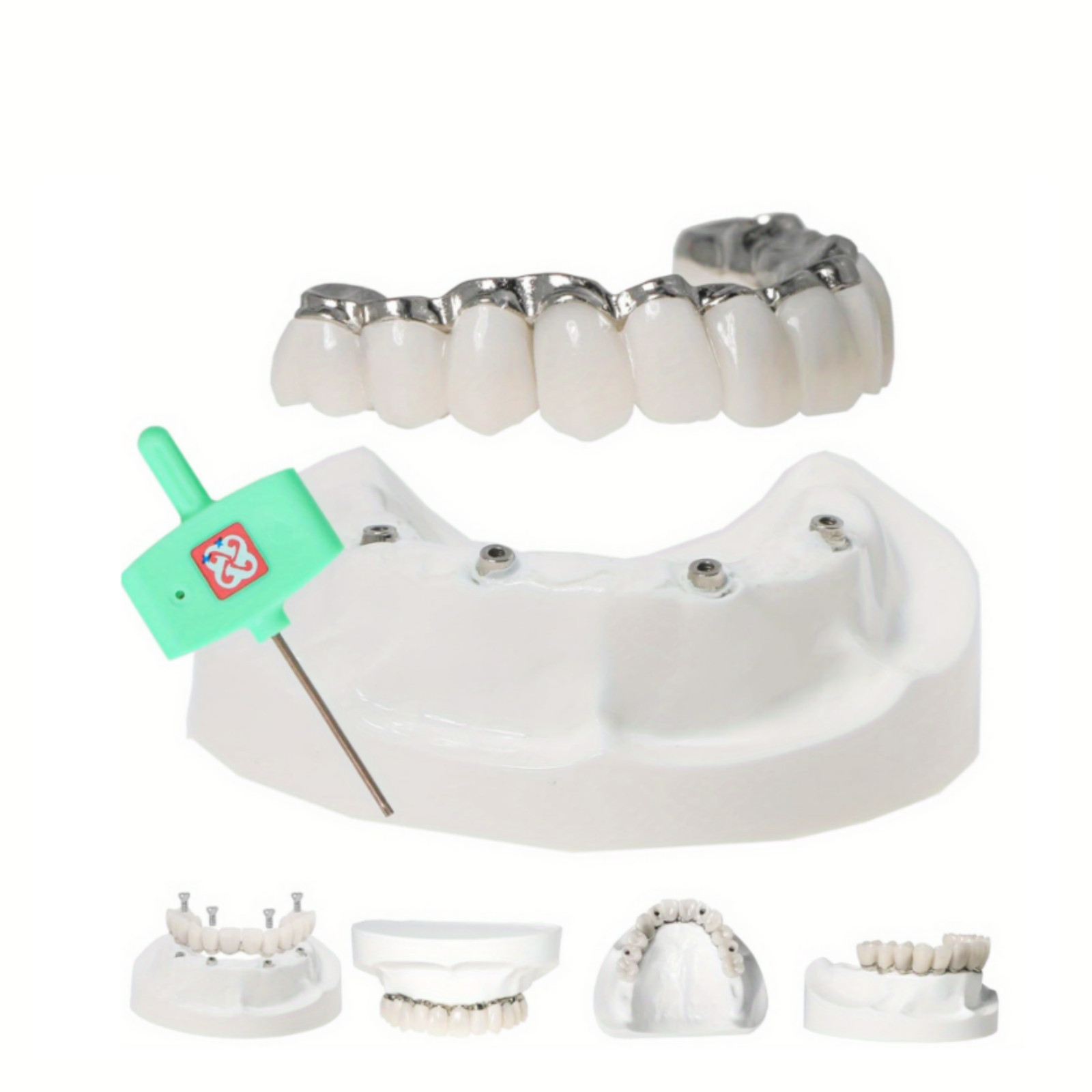 All-on-4 Dental Overdenture Model Dental Upper Jaw Implants Restoration 4 Screws