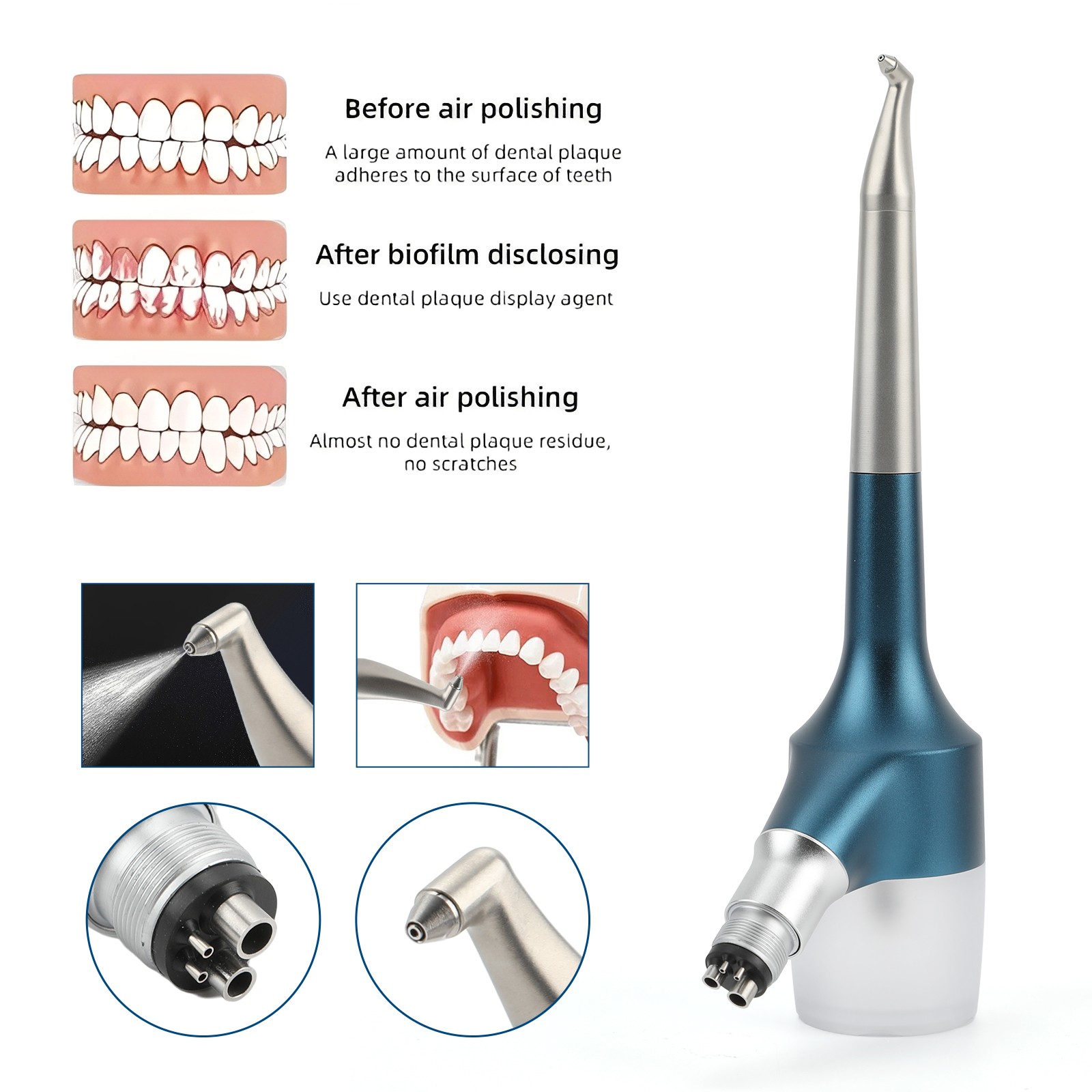 Dental Air Polisher Flow Teeth Prophy Polishing Handpiece Hygiene 4 Hole KV/EMS