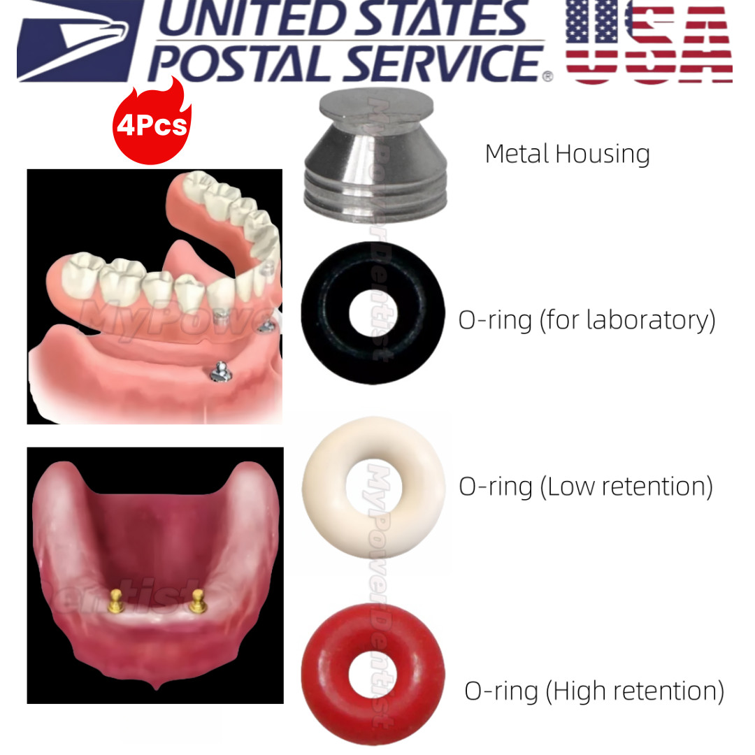 Dental O-ring Caps Ring Retention Cap Implant Fits Hiossen Ball Abutment Osstem