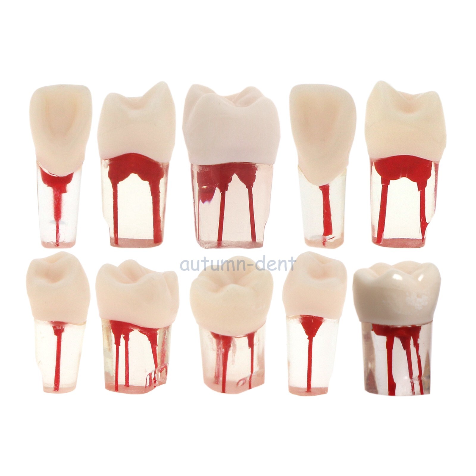 10Pcs Teeth Models Kilgore Nissin Dental RCT Endo Root Canal Practise Typodont