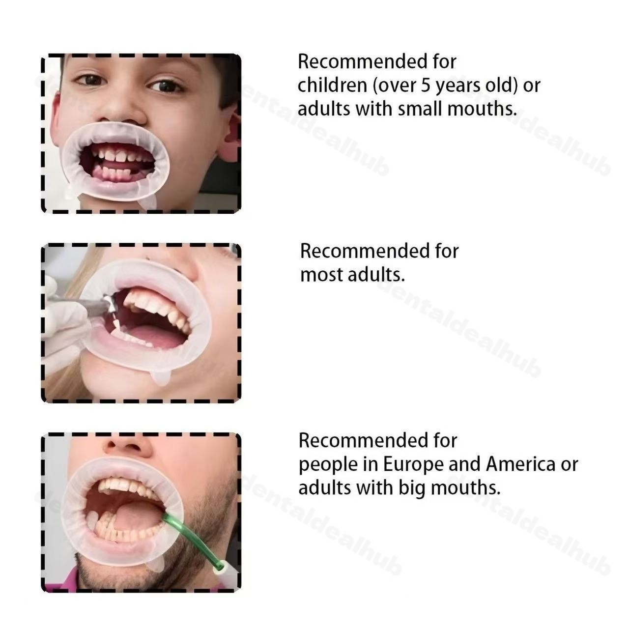 Ivoclar OptraGate Lip Cheek Retractor S/R/J Dental Mouth Opener