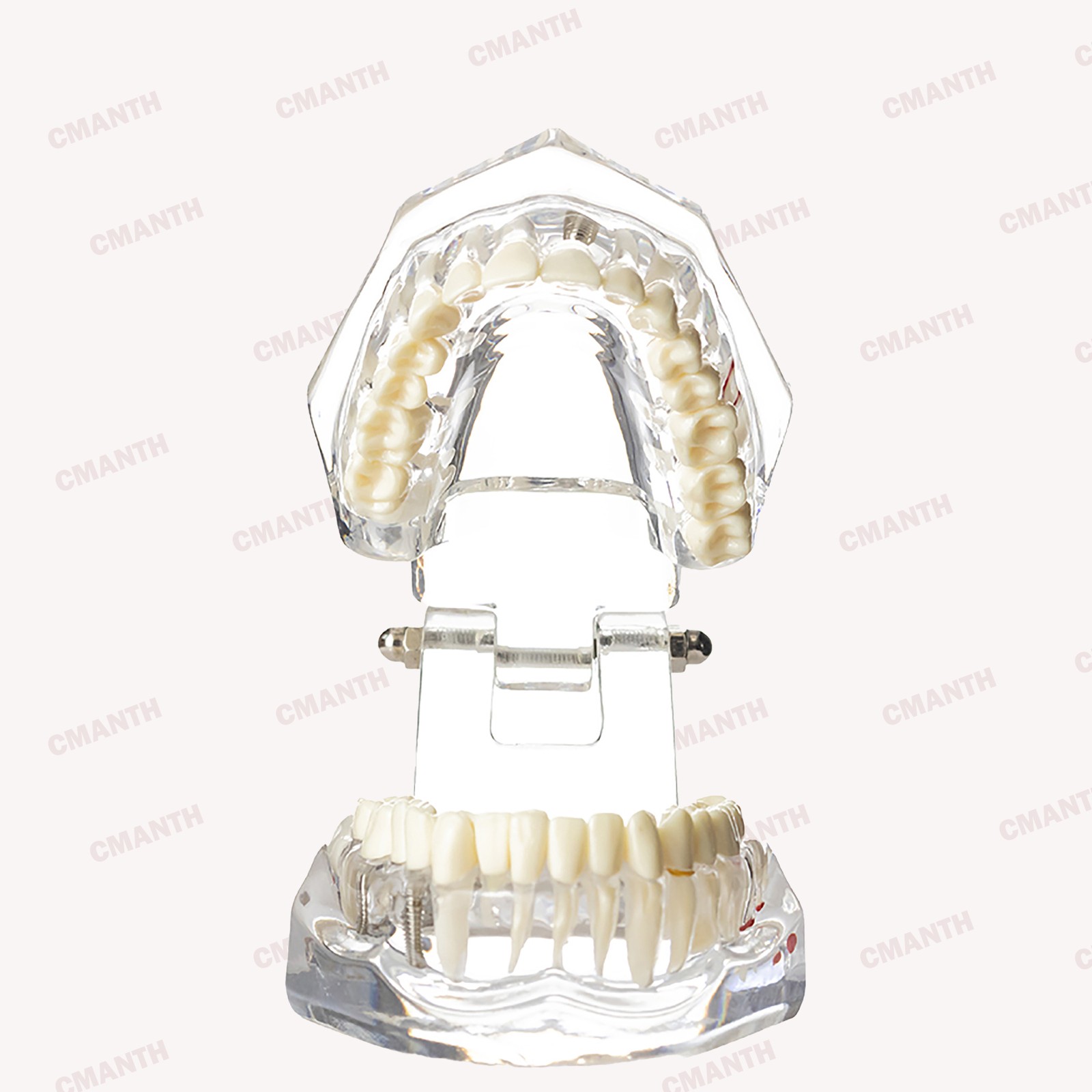 Dental Teeth Model Ortho Implant Practice Teaching of Implants Demo Model