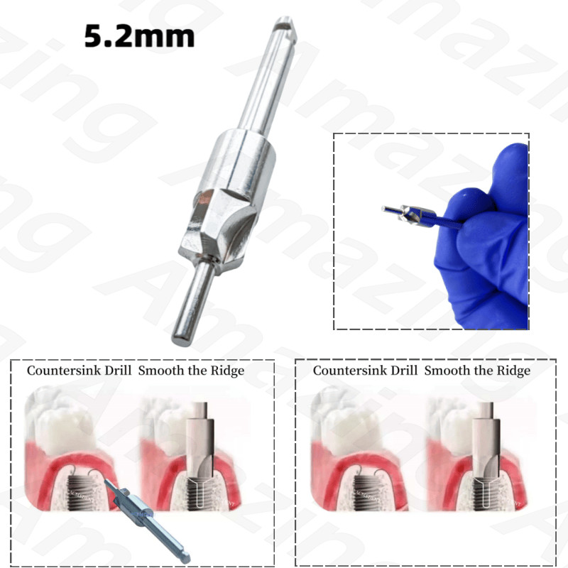 5.2MM Dental Countersink Drill Profiler Remover Smooth Ridge Trimmer Drills