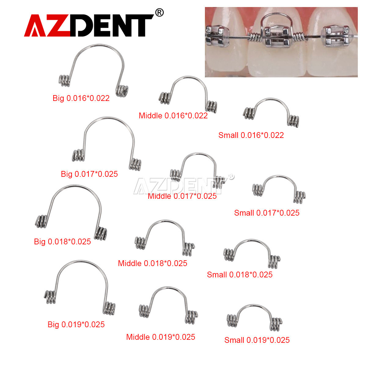 Dental Ortho Anterior Teeth Torque Rectangular Springs 10Pcs/ Big Middle Small