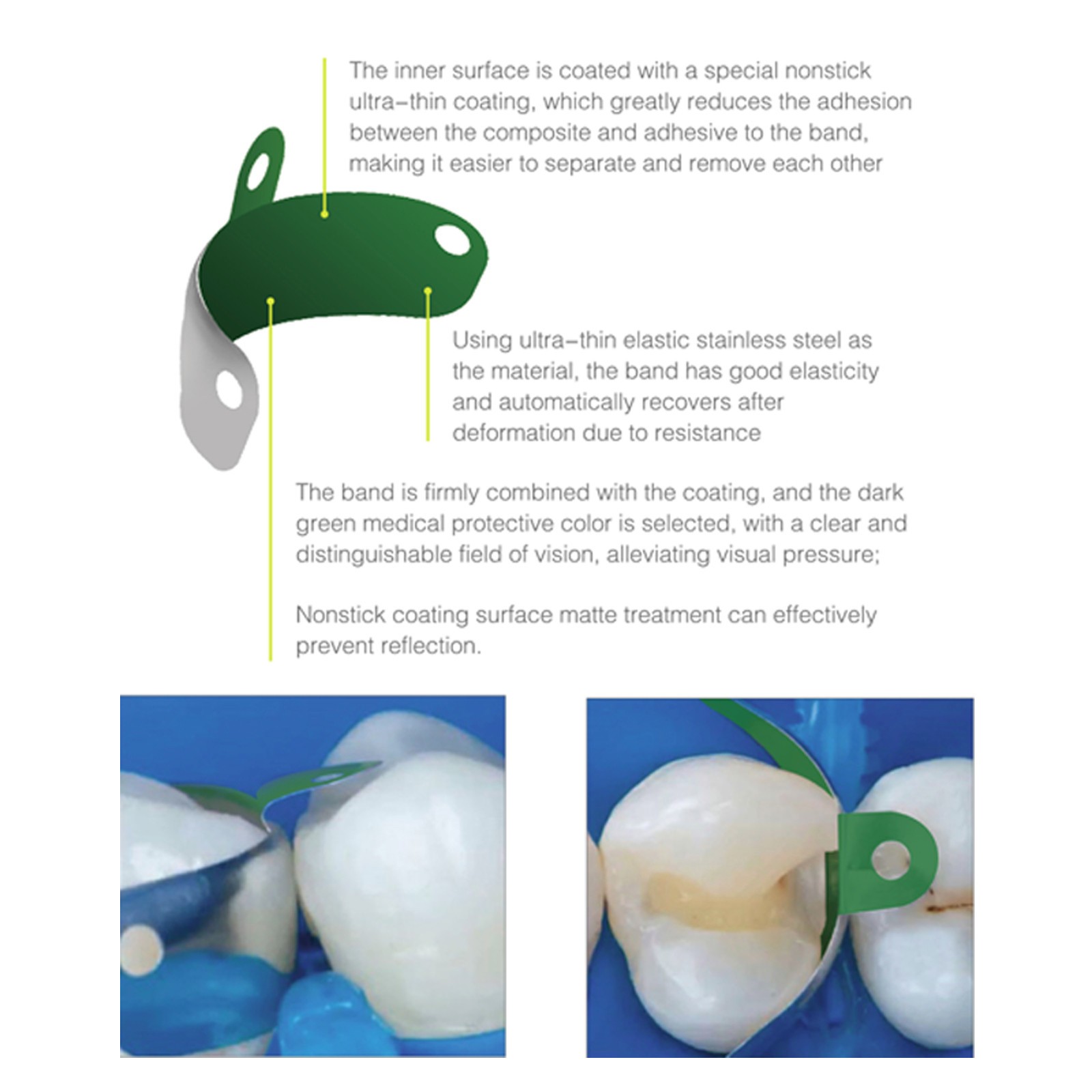 Sectional Matrix System Bands 3D Fusion Professional Kits Garrison Palodent V3