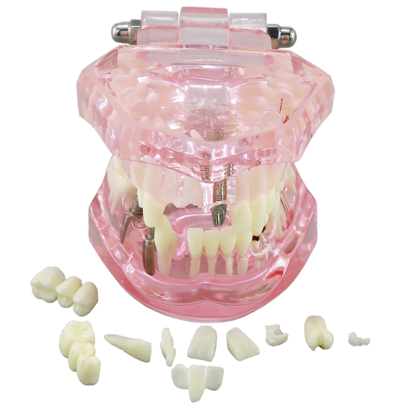 Dental Implant Teeth Model Teach Study Demo Restoration Pathology #2001 Pink
