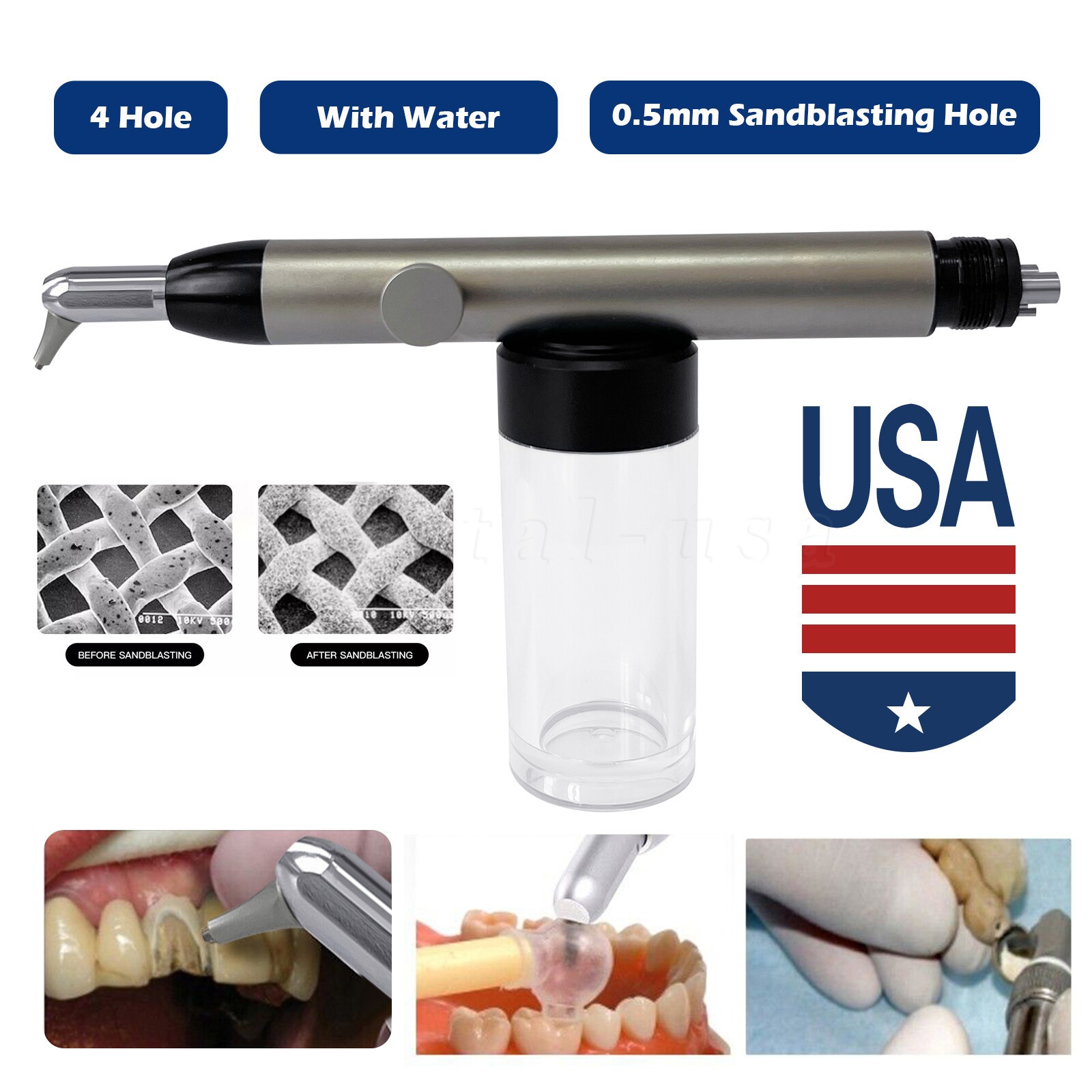 Dental Aluminum Oxide Micro Blaster Air Abrasion Polisher w Water Spray 4 Holes
