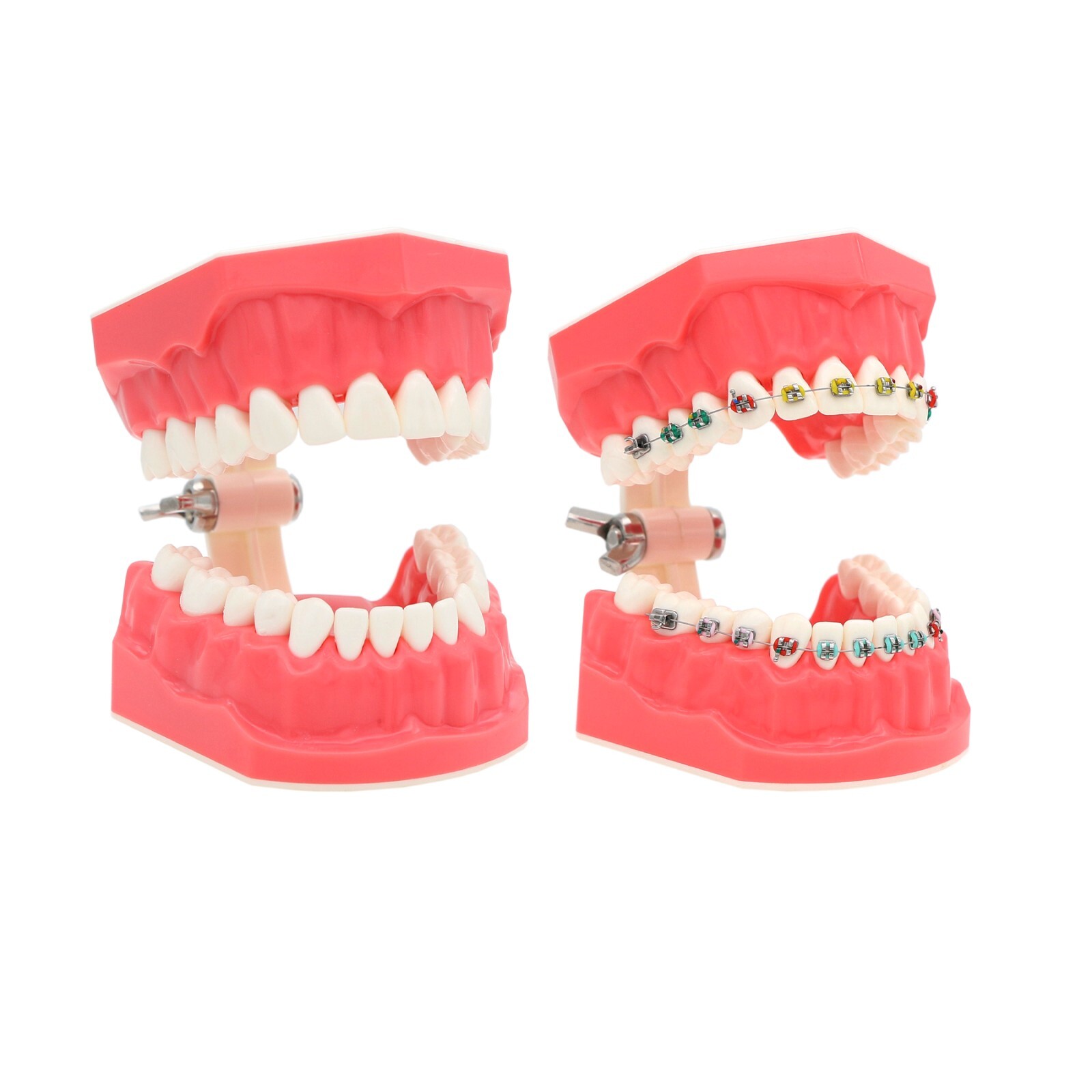 Dental Typodont & Implant Models – Educational, Pathology, Restoration Training