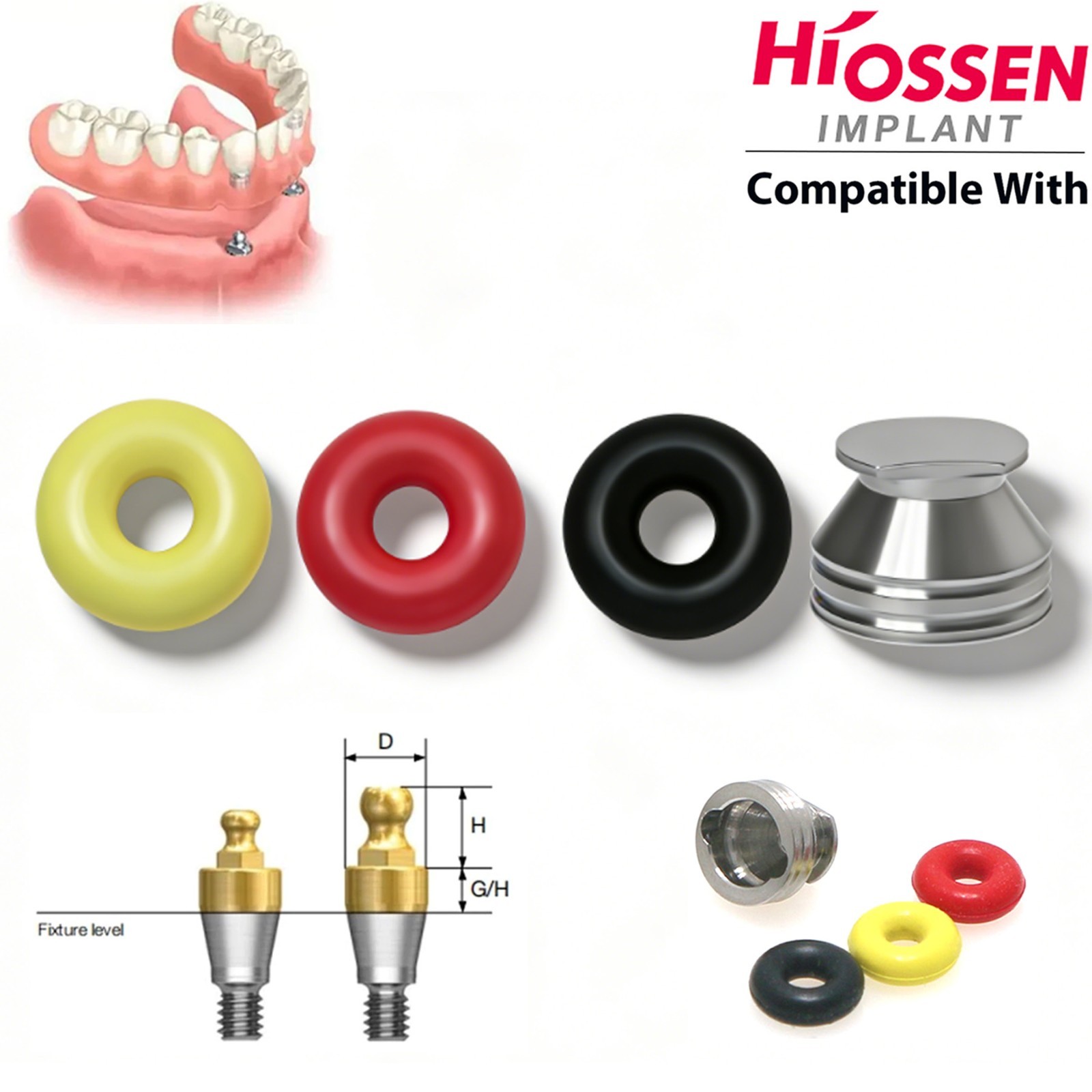 US Dental Implant O-ring Kit for Hiossen Osstem Ball Attachment Abutments