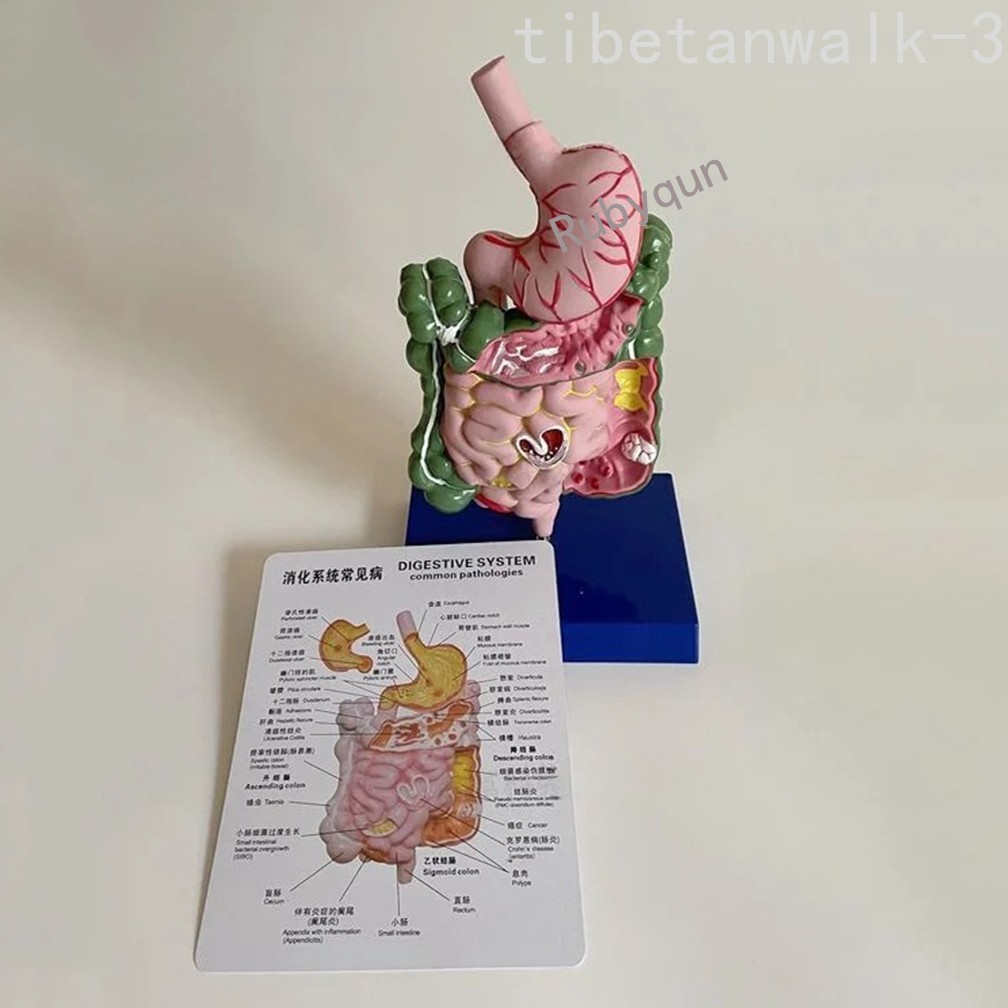 Human Digestive System Model Stomach Esophagus Stoh Large Small Intestine Ileum