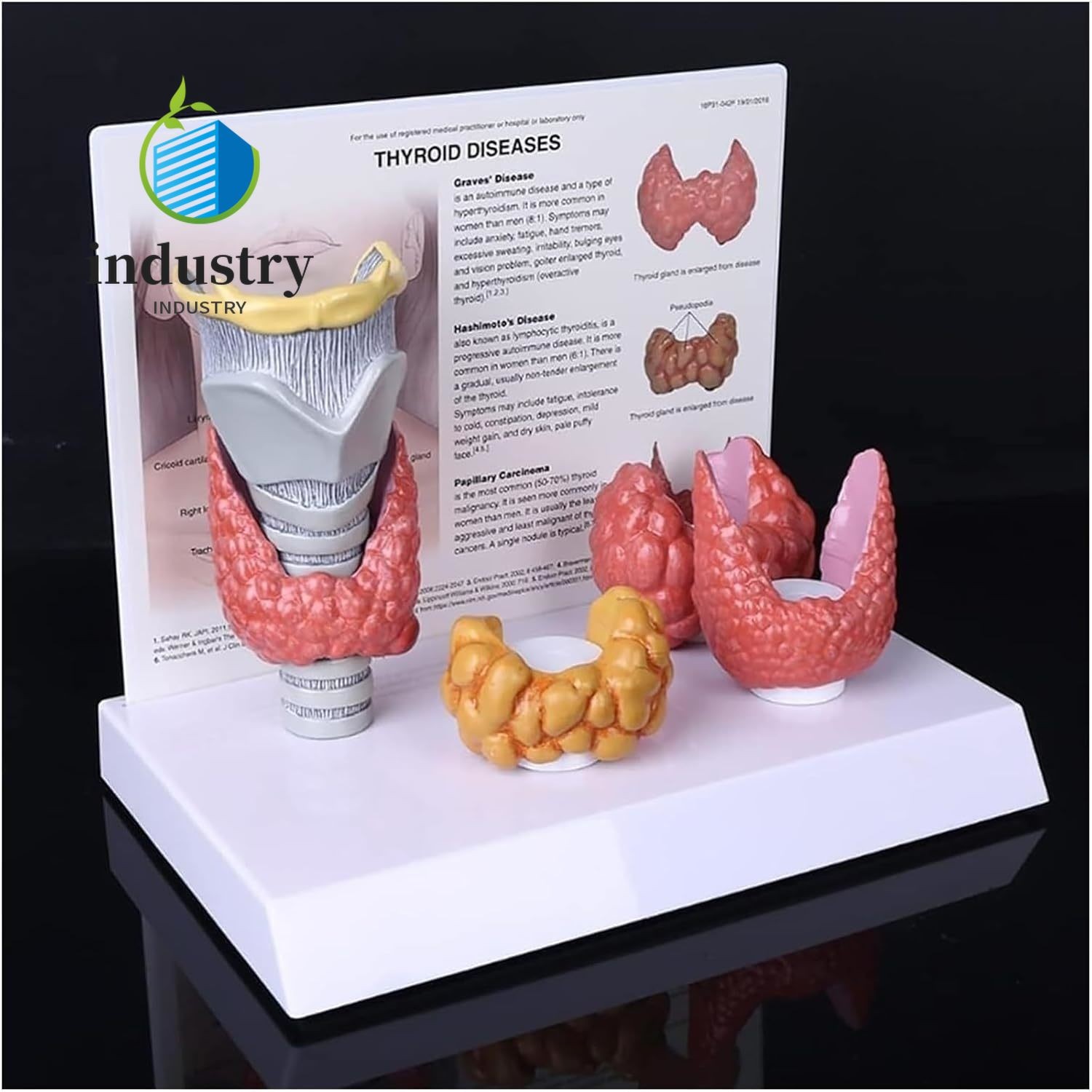 4pcs Set of Human Thyroid Pathological Anatomical Models Throat and Thyroid