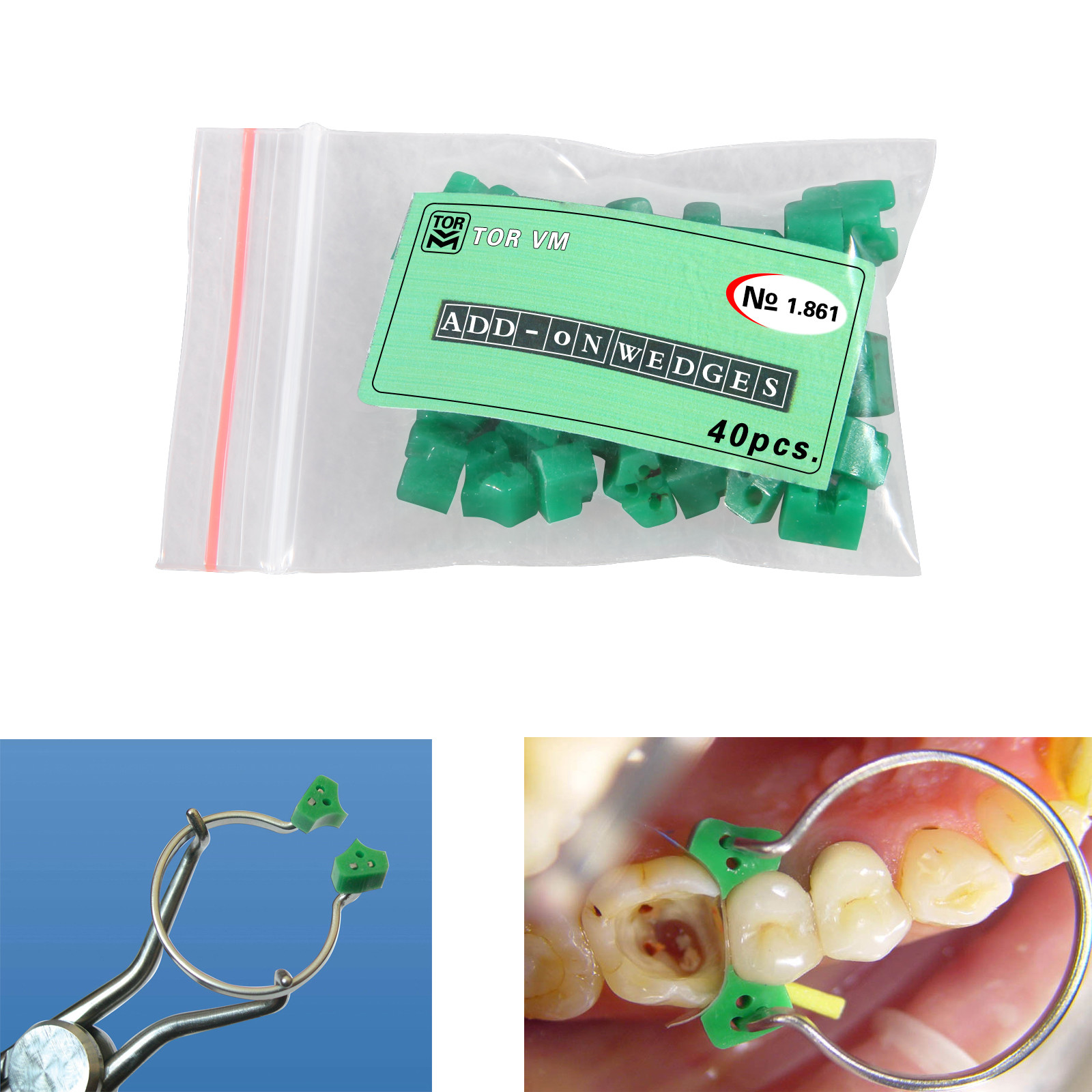 40 PCs Dental Add On Wedges 1 Pack 40 pcs № 1.861