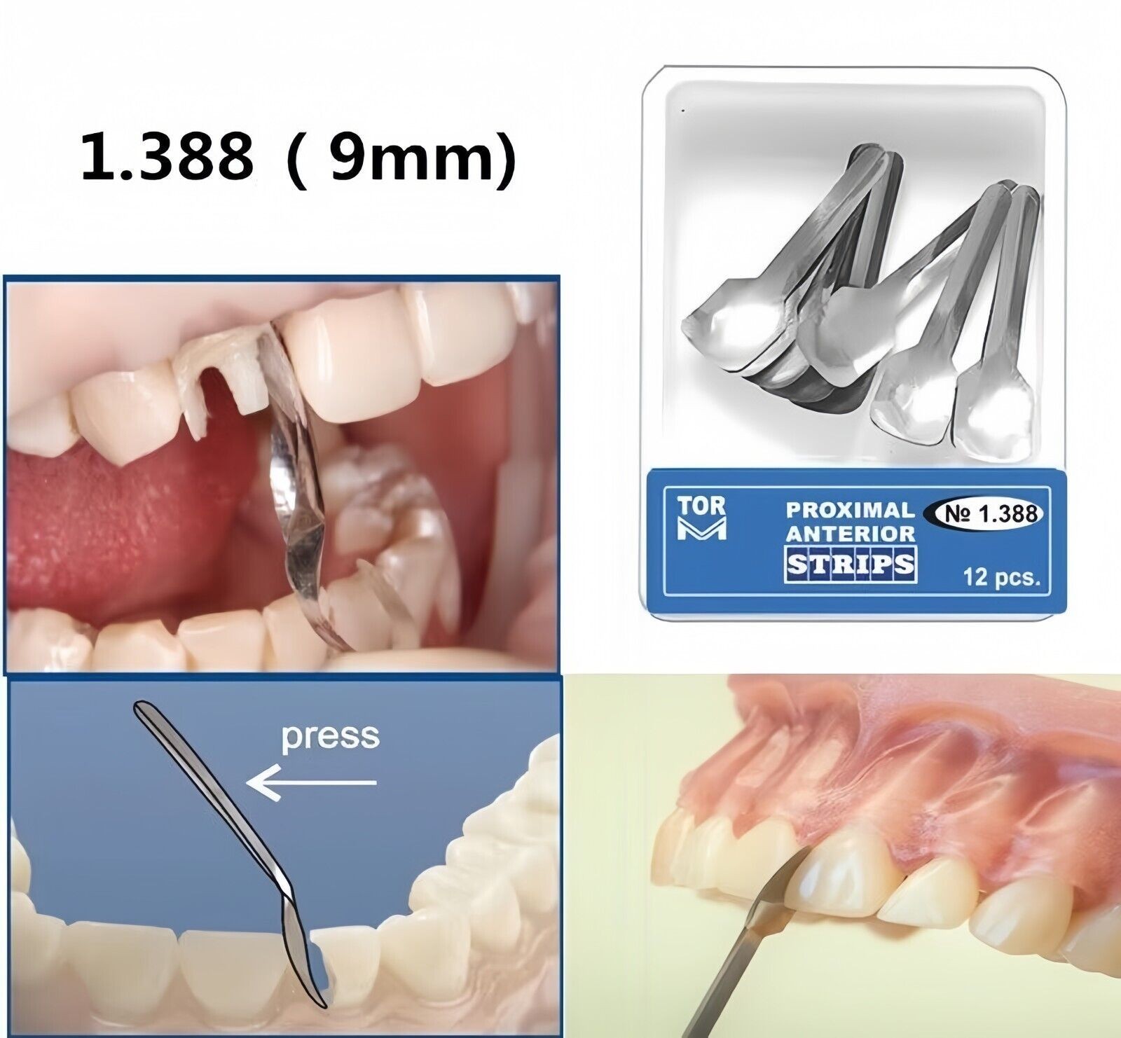 Dental Anterior Matrix Bands Proximal Strips Sectional Contoured Twin Matrices