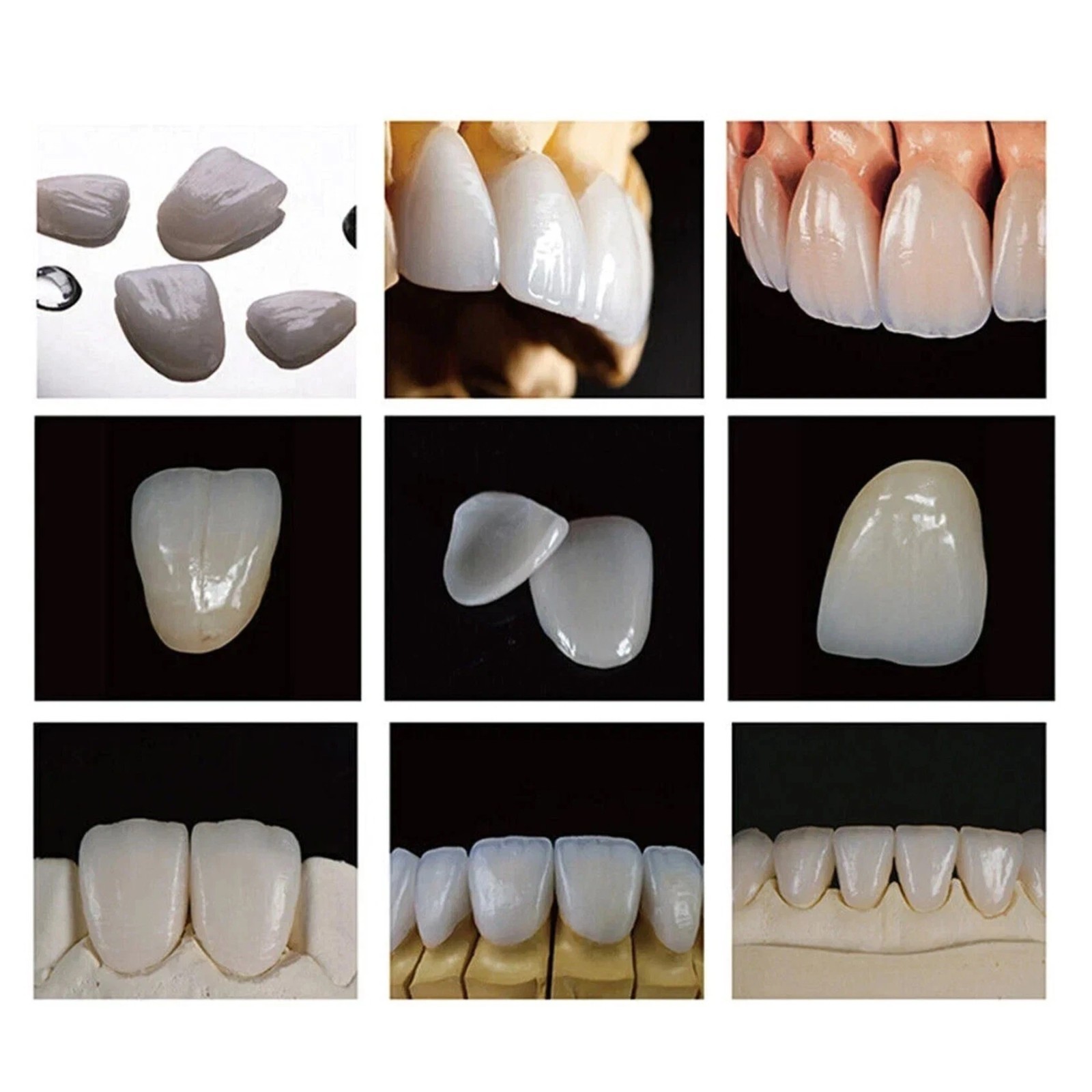 C14 Dental Emax Ceramic Blocks Lithium Disilicate CAD/CAM CEREC Block 5Pcs/box
