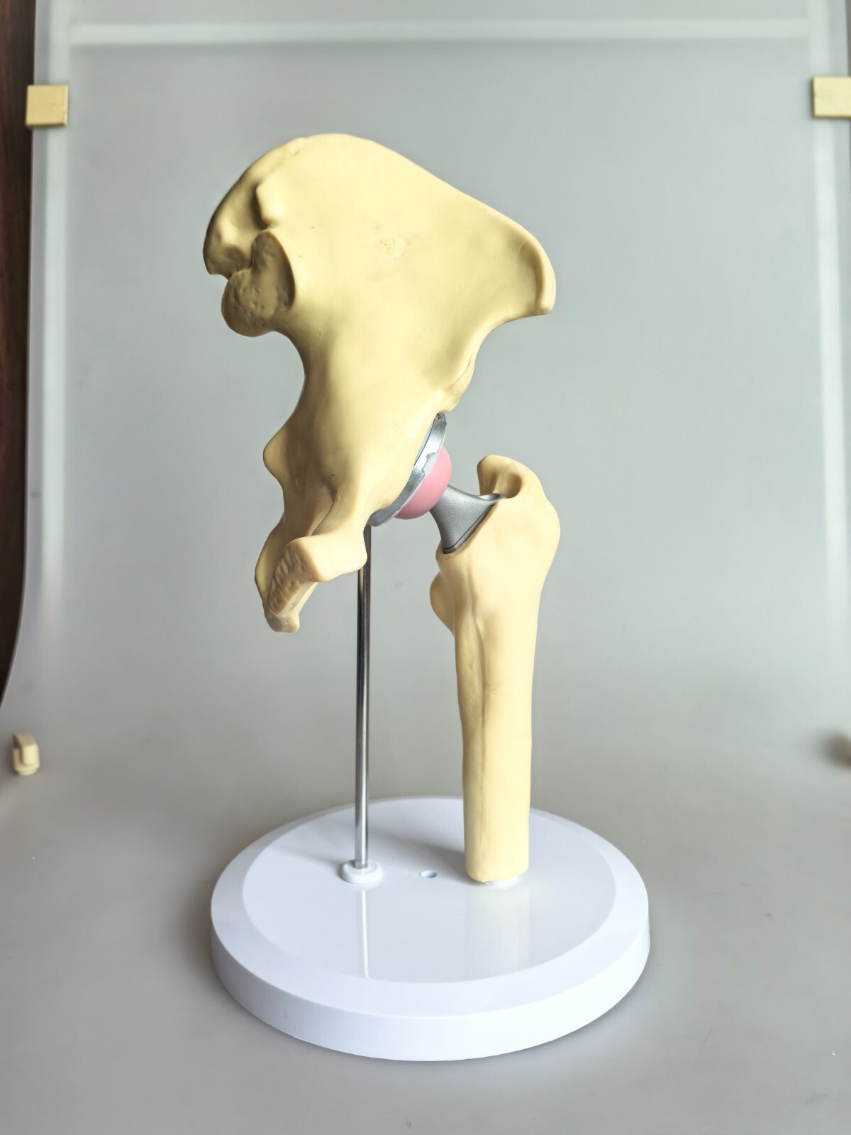 1:1 Artificial Hip Joint Replacement Medical Anatomical Skeleton Model Display