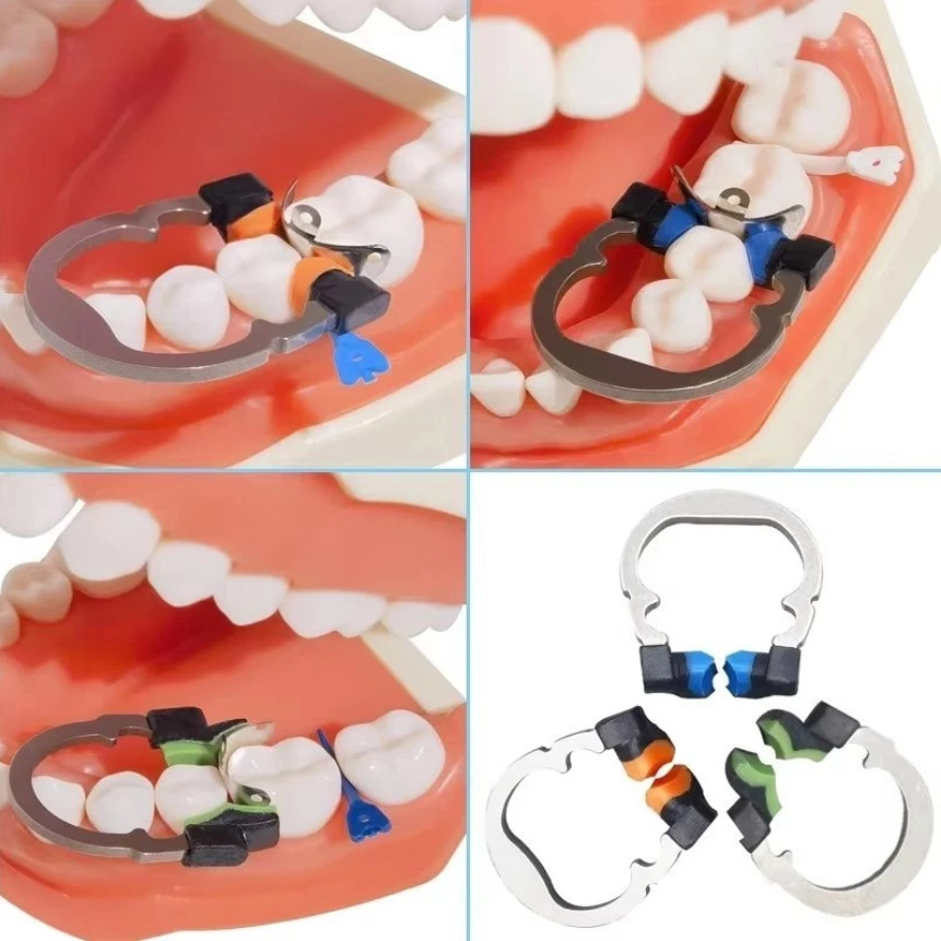 Dental Matrix Bands Ring Sectional Matrice Clamp Fit Garrison Palodent V3 System