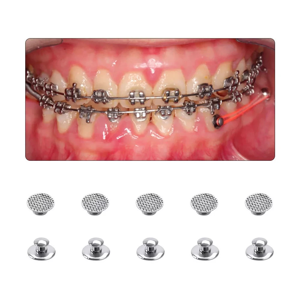 50Pcs Dental Orthodontic Bondable Split Metal Lingual Buttons Round Mesh Base