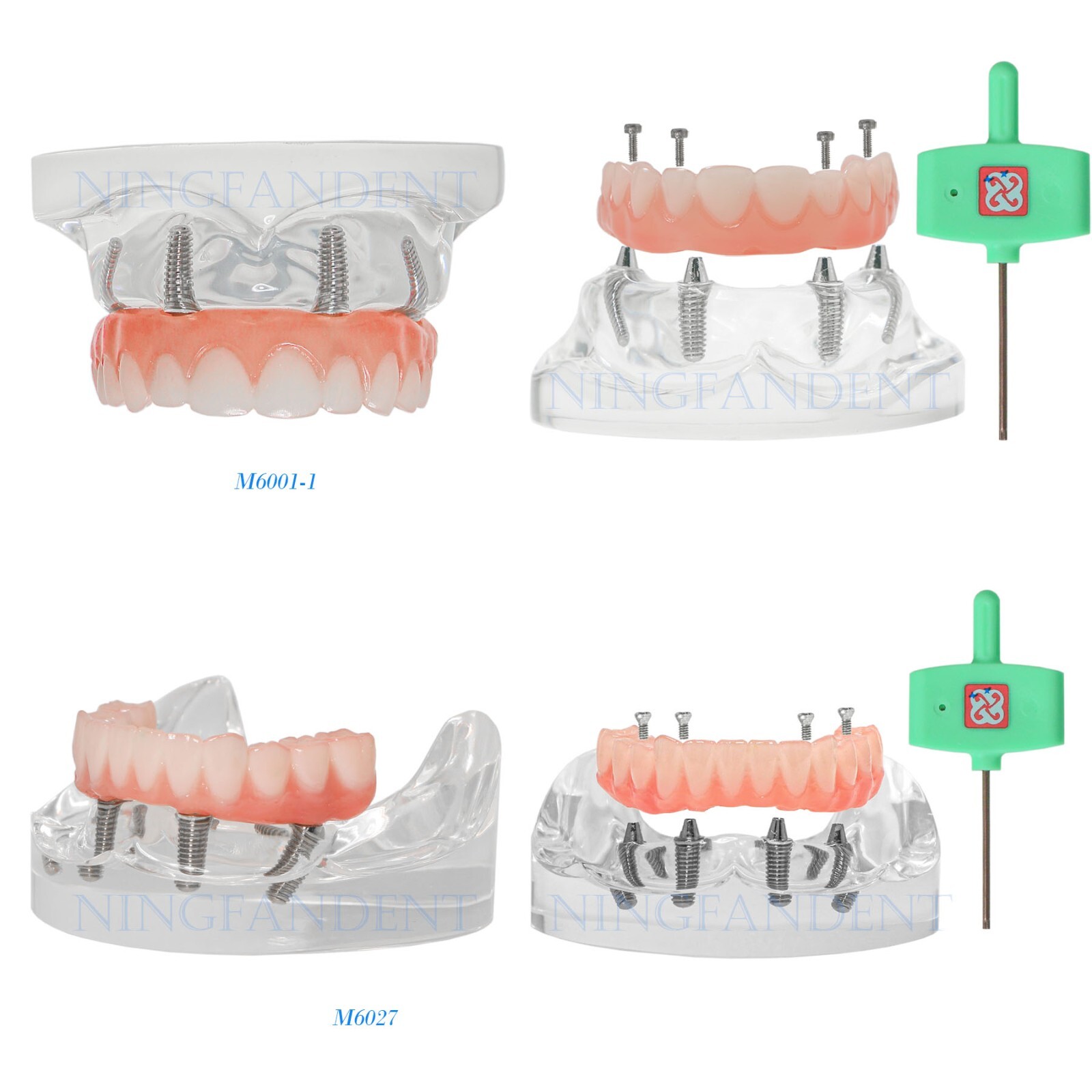 US Dental Implant Demo All-On-4 Treatment Repair Model Upper/Lower Jaw Kit,Clear