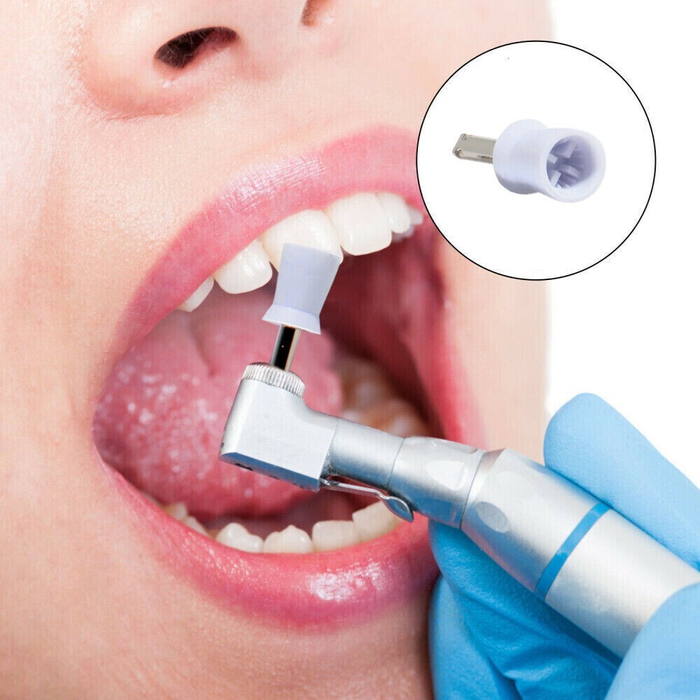 100Pcs Dental Prophy Polishing Cups Rubber Teeth Brush Latch Type White 4 Webbed