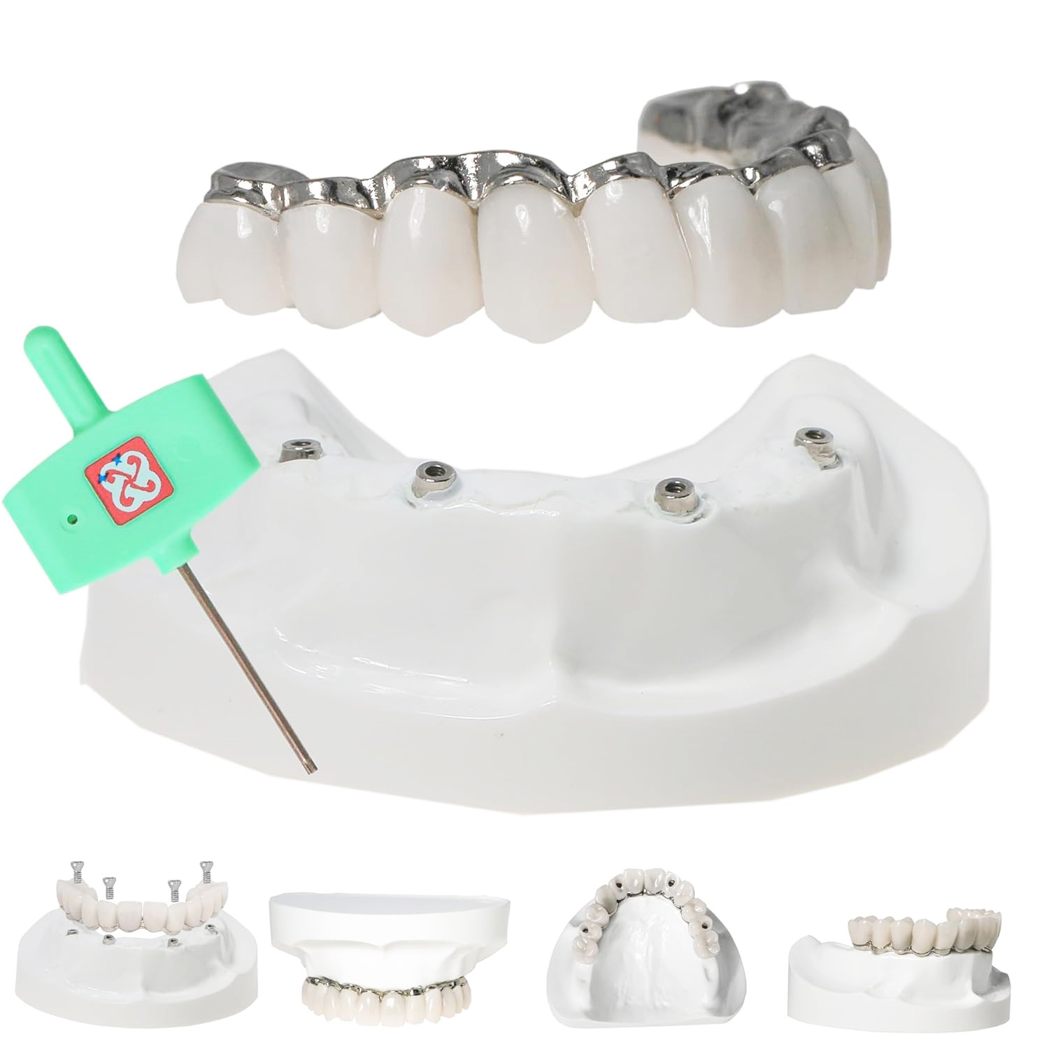Dental Implant Model Implant Restoration M6023 Upper Jaw All-on-4 Overdenture US