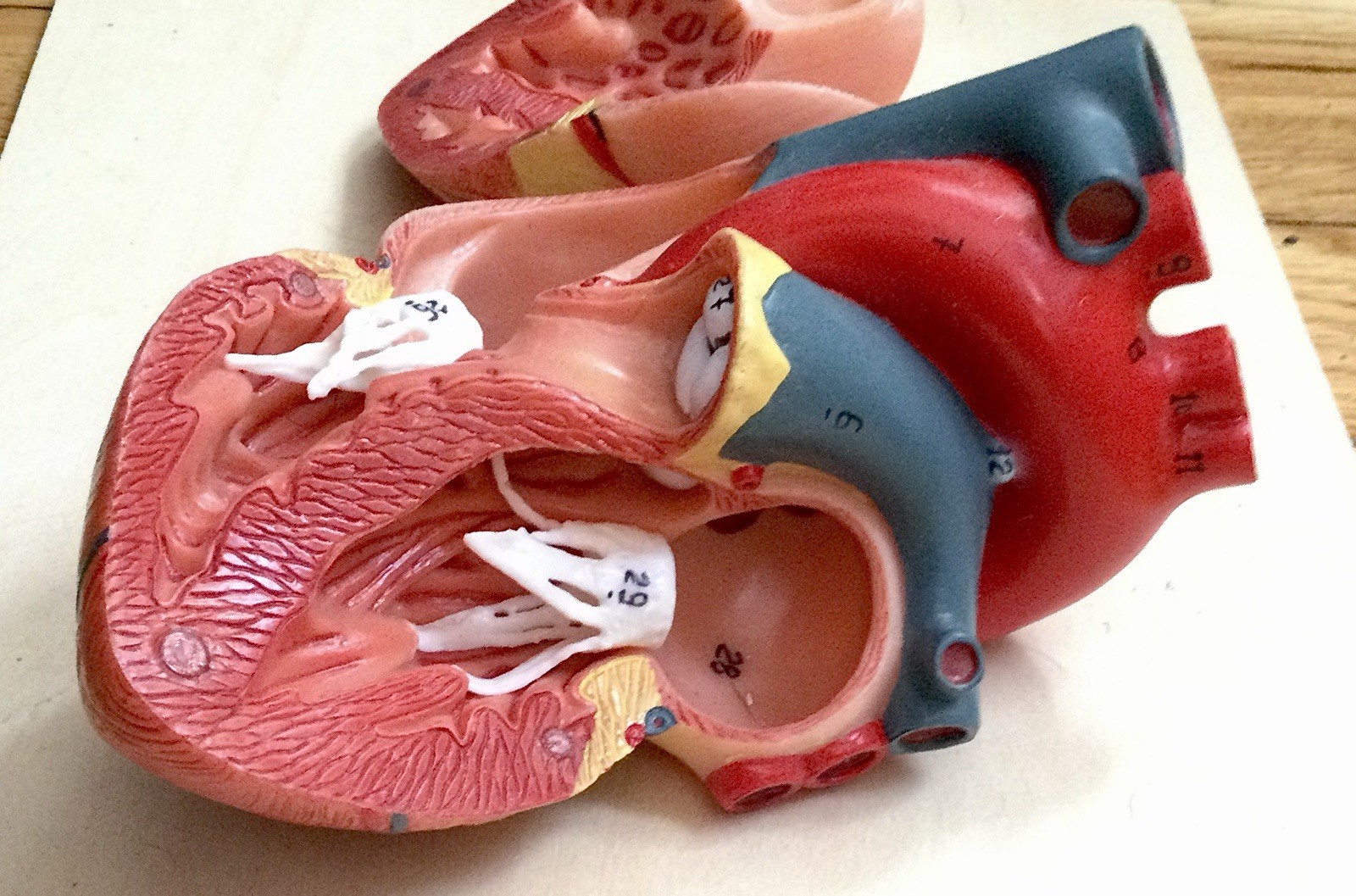 EVOTECH Scientific Anatomical Heart Model Dissectible Educational Display