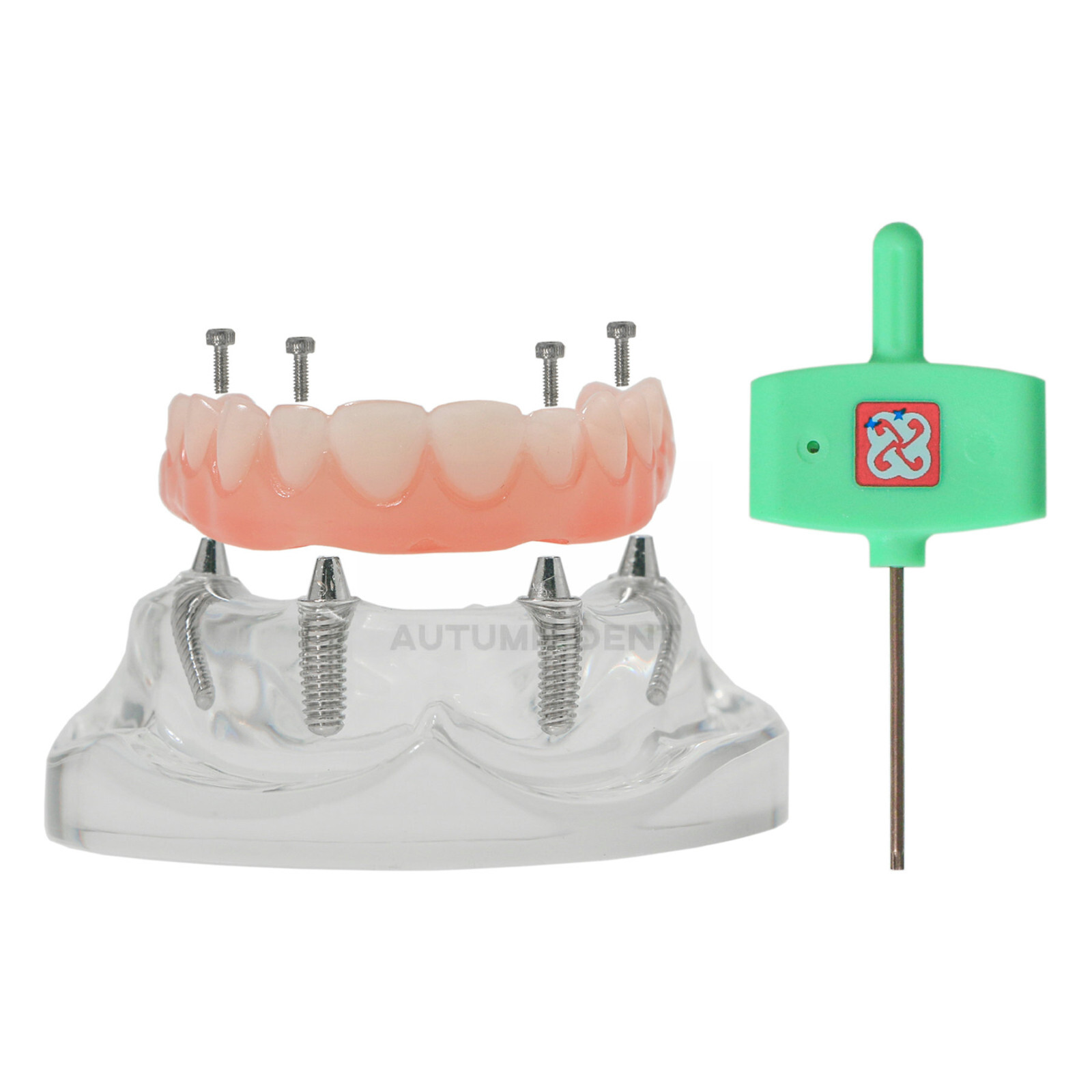 US Dental 4 Screws Overdenture Model All on 4 Restoration Upper/Lower Jaw Type
