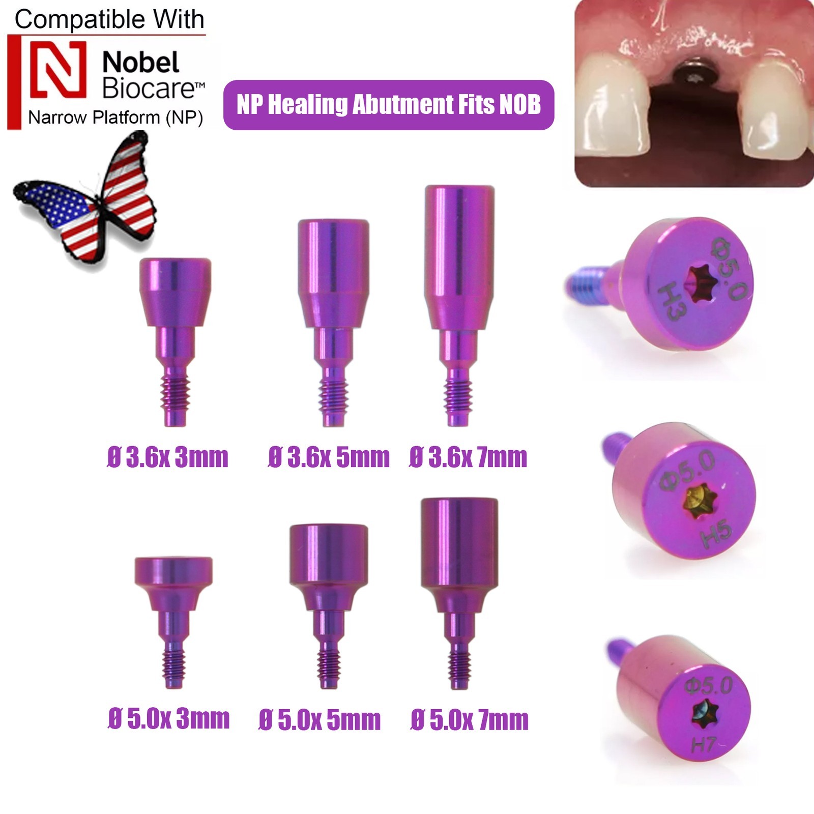 US Nobel Active Nobel Parallel CC Healing Abutment Compatible Conical Connection