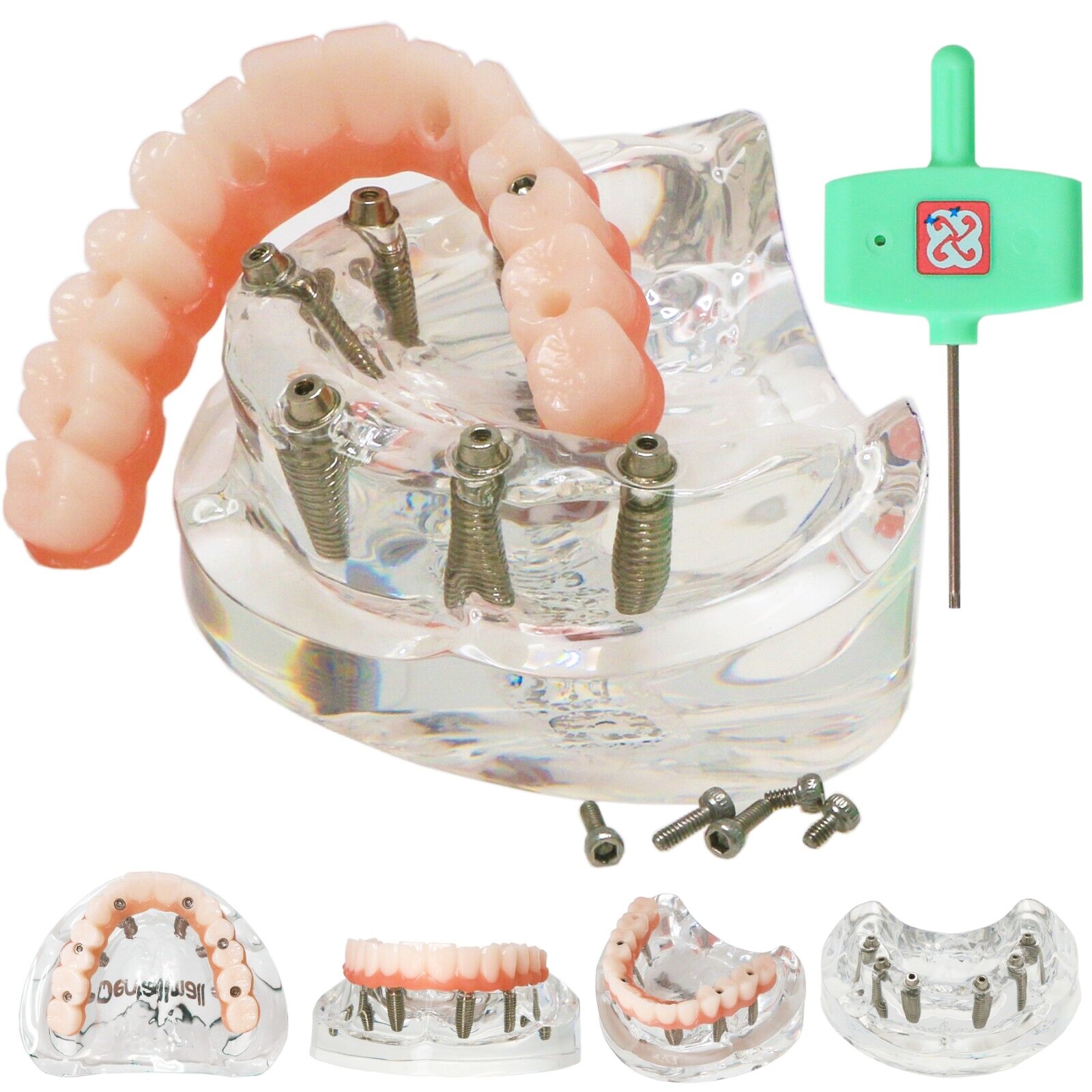 US Dental Implant Overdenture Model All-On-6 Treatment Upper jaw 6 Screws Clear