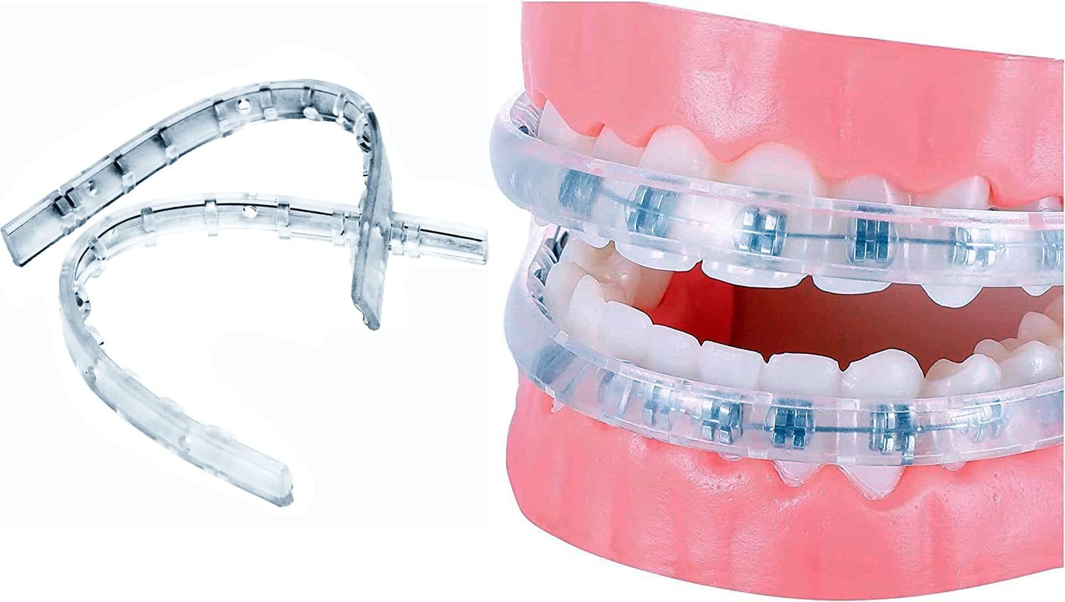 Comfort Cover for Braces, Lip Protector Mouth Guard Cushion Teeth Clear