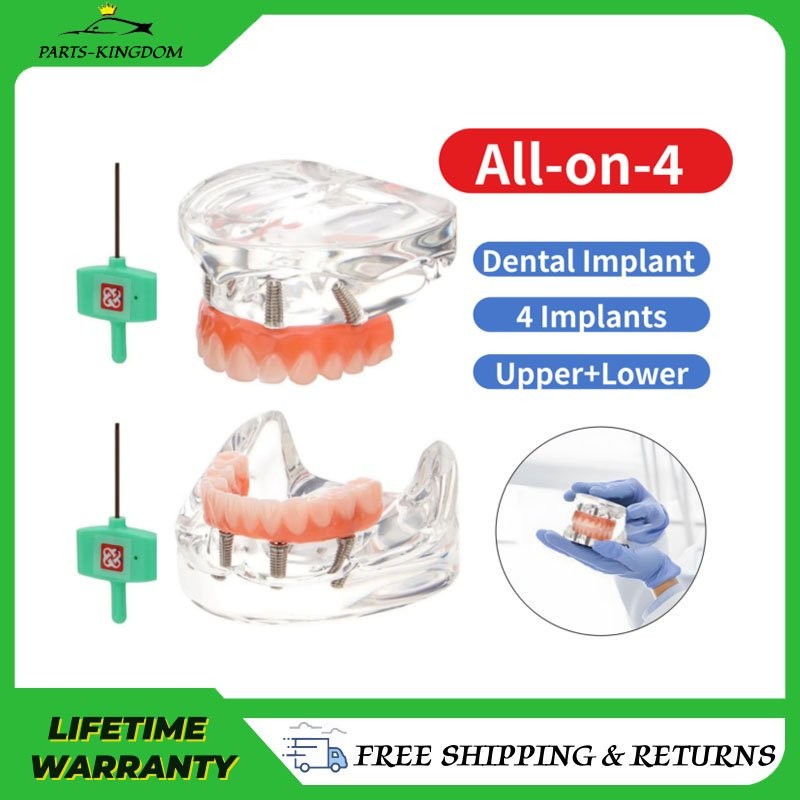 Dental Implant All-on-4 Overdenture Treatment Model Upper/Lower 4 Implants New