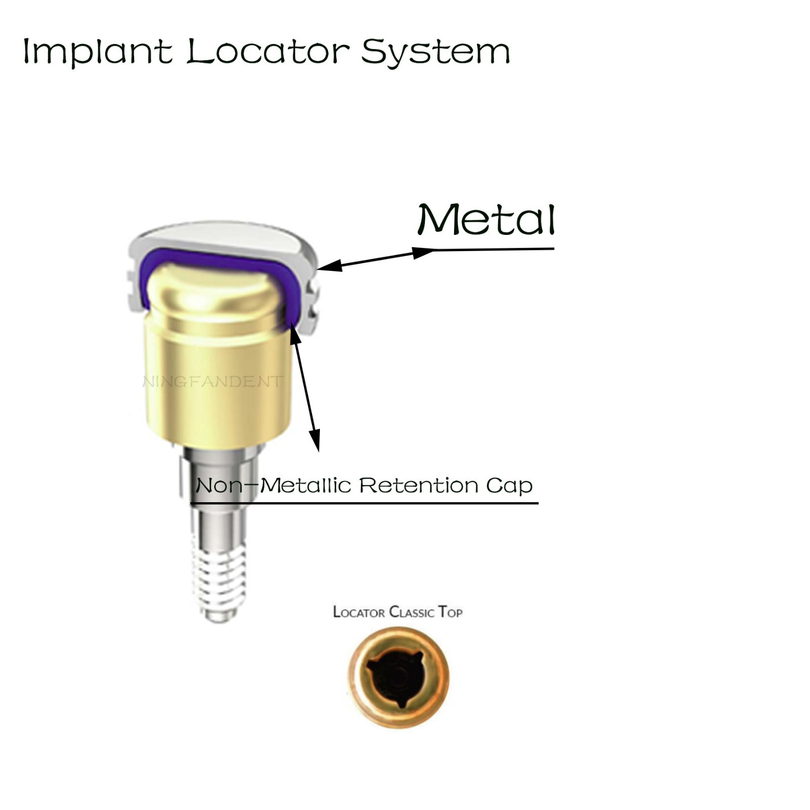 US Dental overdenture Locator Metal Housing & Replace Lab Cap Inserts Assembly