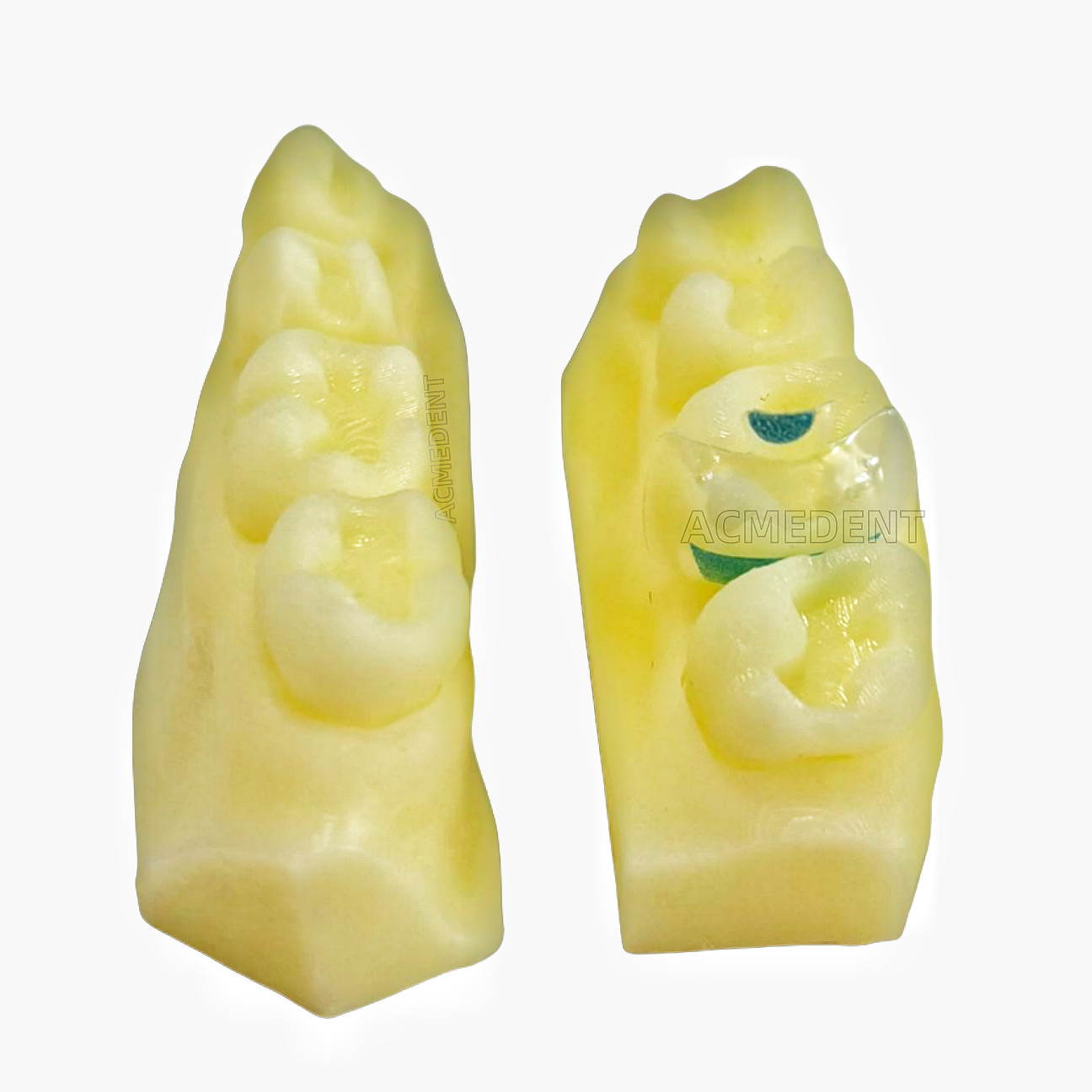 10Sets Dentist Education Sectional Matrix Daily Practice Course Composite Resin