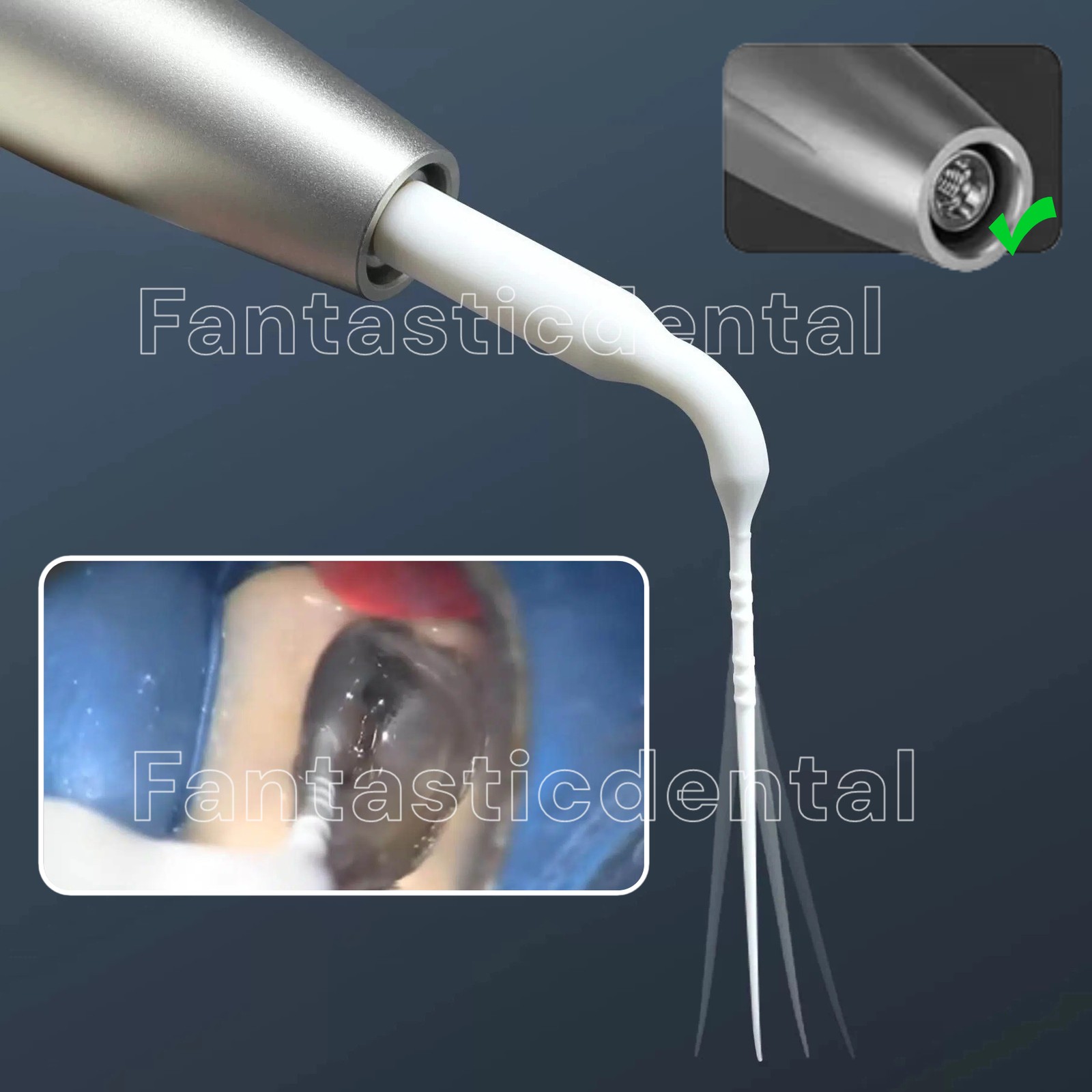 Dental Sonic Powered Tips Endo Irrigation Activating Irrigants EDDY VDW 22/28mm