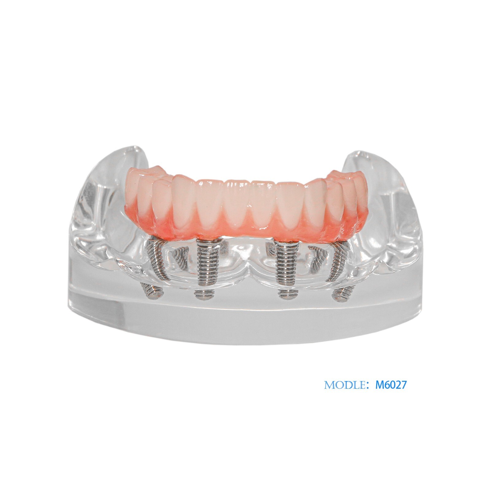 Dental Transparent Lower Jaw Malone Bridge All-on-4 Overdenture Typodont Model