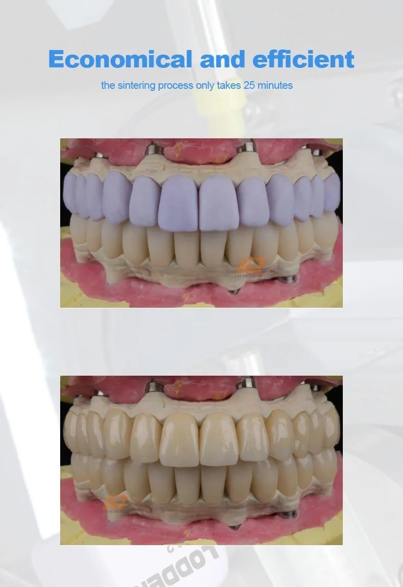 Dental Lithium Disilicate Blocks C14/B40/A16 Glass Ceramic Sirona Cerec LT/MT/HT