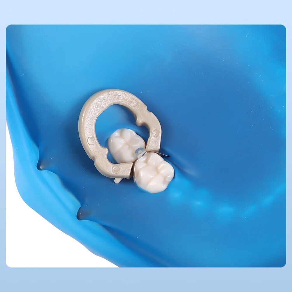 Dental Matrix Bands Sectional Matrices Contoured Refill 3D Holes Fit Garrison