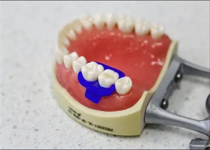 20pcs Dental Mini Dam MiniDam Rubber Dam Clamp Holder Dental Silicone Rubber Dam