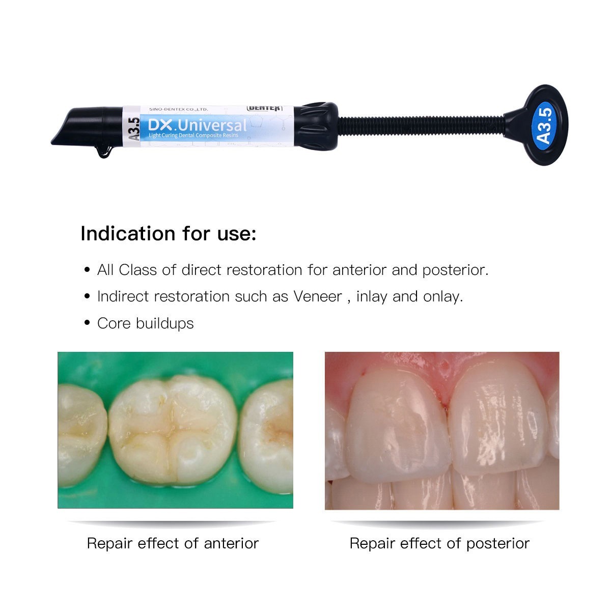 Dental Universal Curing Light Cure Hybrid Composite Resin /LED Curing Light Lamp