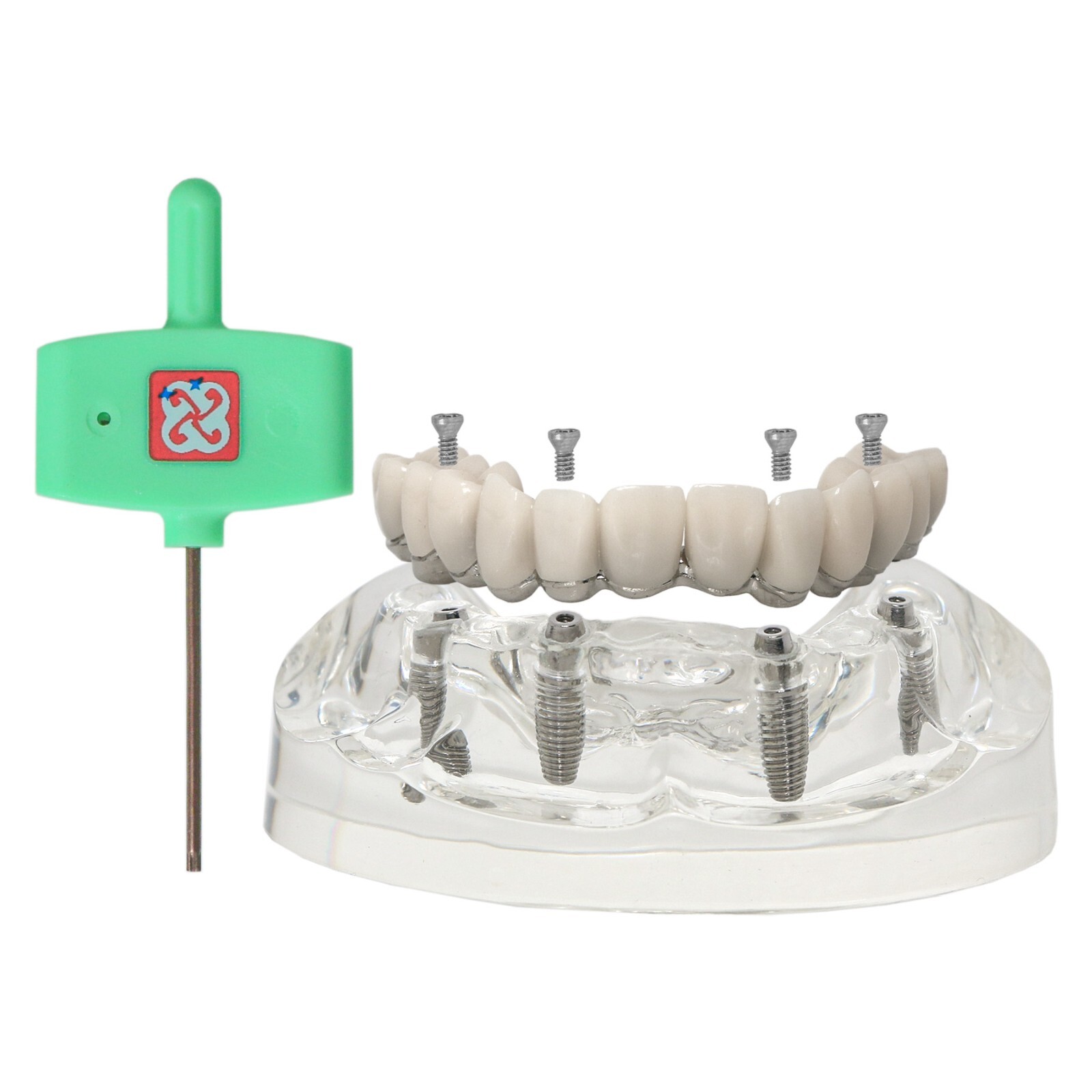 All-on-4 Overdenture Clear Model Dental Implant Upper Jaw Restoration 4 Screws