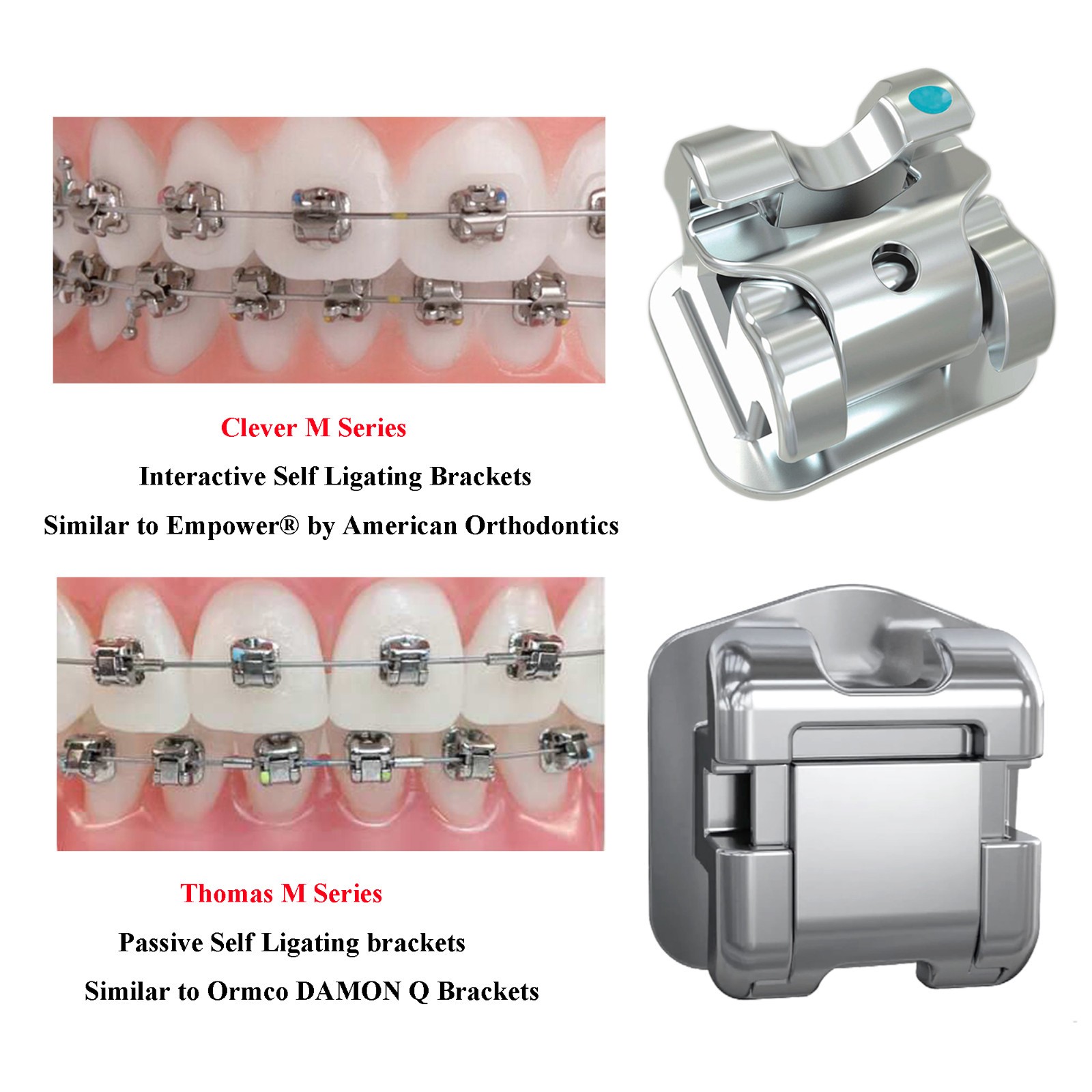 Orthodontic Brackets Clever Thomas Metal Damon AO Empower Self Ligating Braces