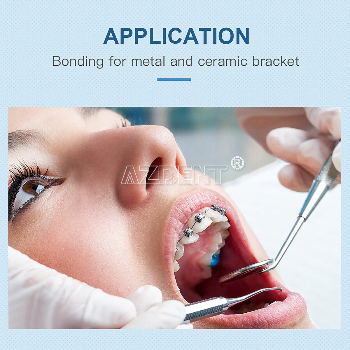 Dental Orthodontic Metal Ceramic Bracket Bonding Light Cure Adhesive Syringe Kit