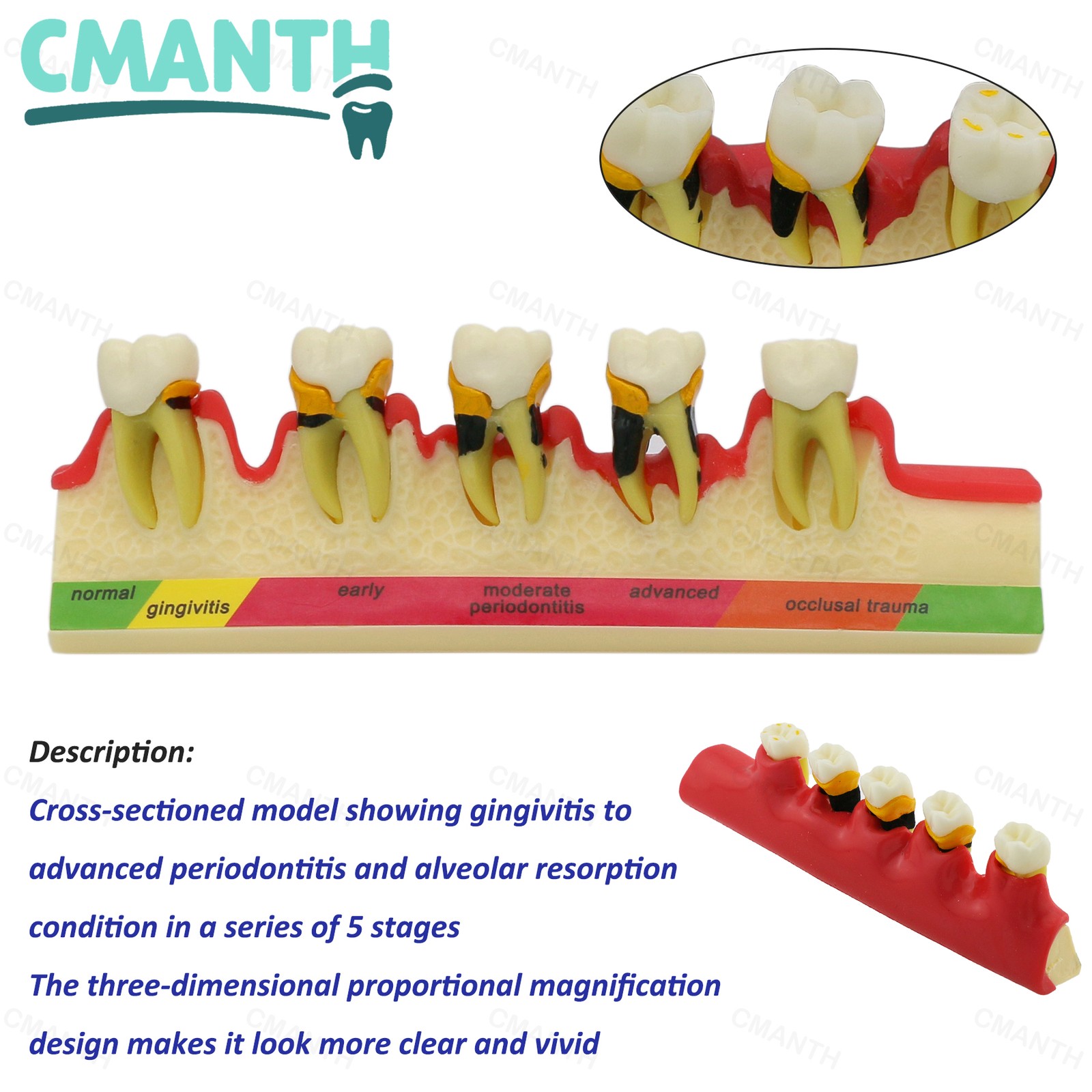 Dental Teeth Model Orthodontic Model Teaching Studying Implant Models Dental Lab