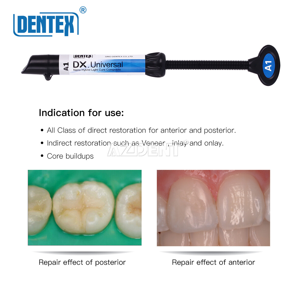 Dentex Dental Light Cure Universal Composite Resin Refill A1 Shade 4g/Syringe US