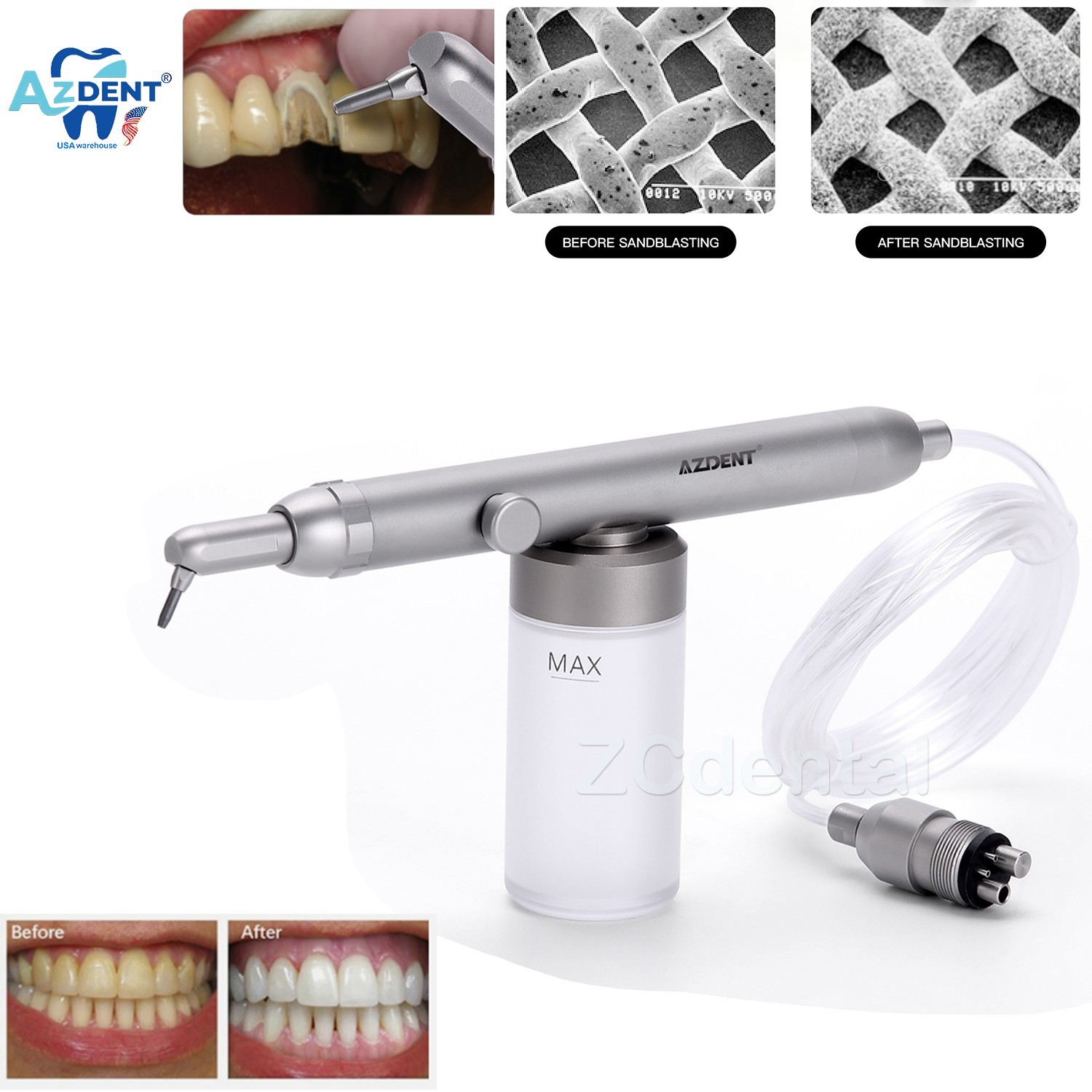 Dental Abrasión Aire Pulidor Óxido Aluminio Micro Blaster Agua Spray 4 Agujero