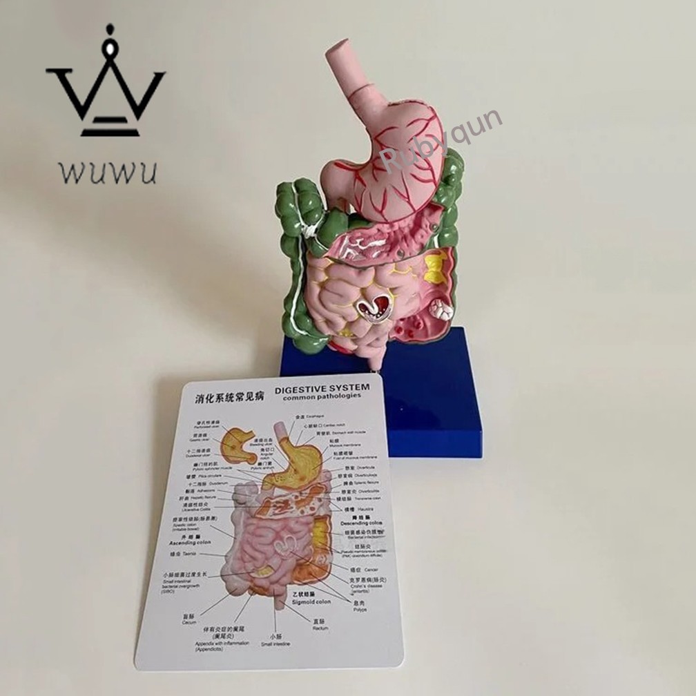 Human Digestive System Model Stomach Esophagus Stoh Large Small Intestine Ileum