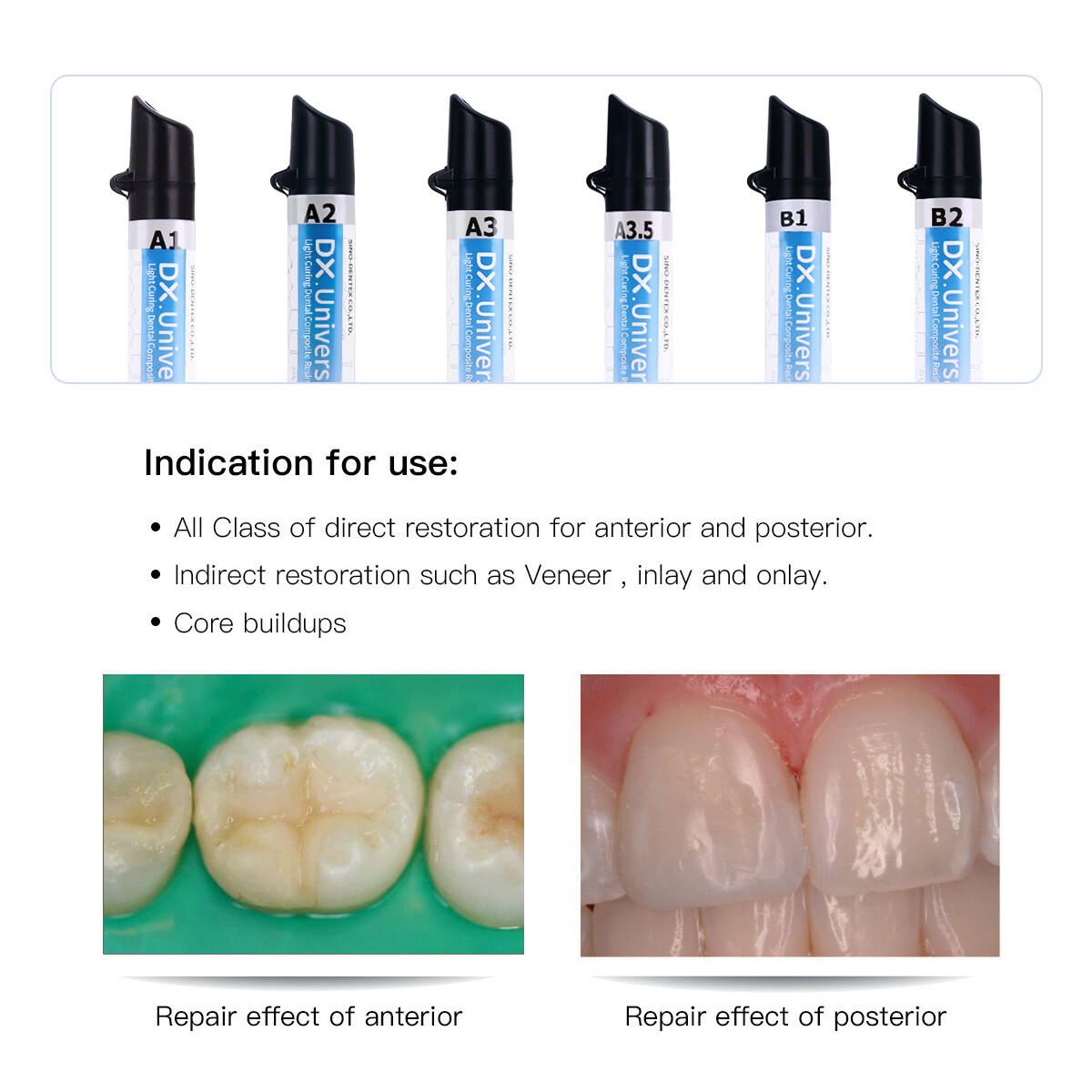 Dentex Dental Composite Resin Flowable Medium Temporary C&B Resin A1 A2 A3